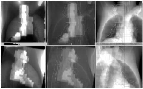 Shooting and Verification Method of Intensity Modulated Radiation Field Confirmation Film