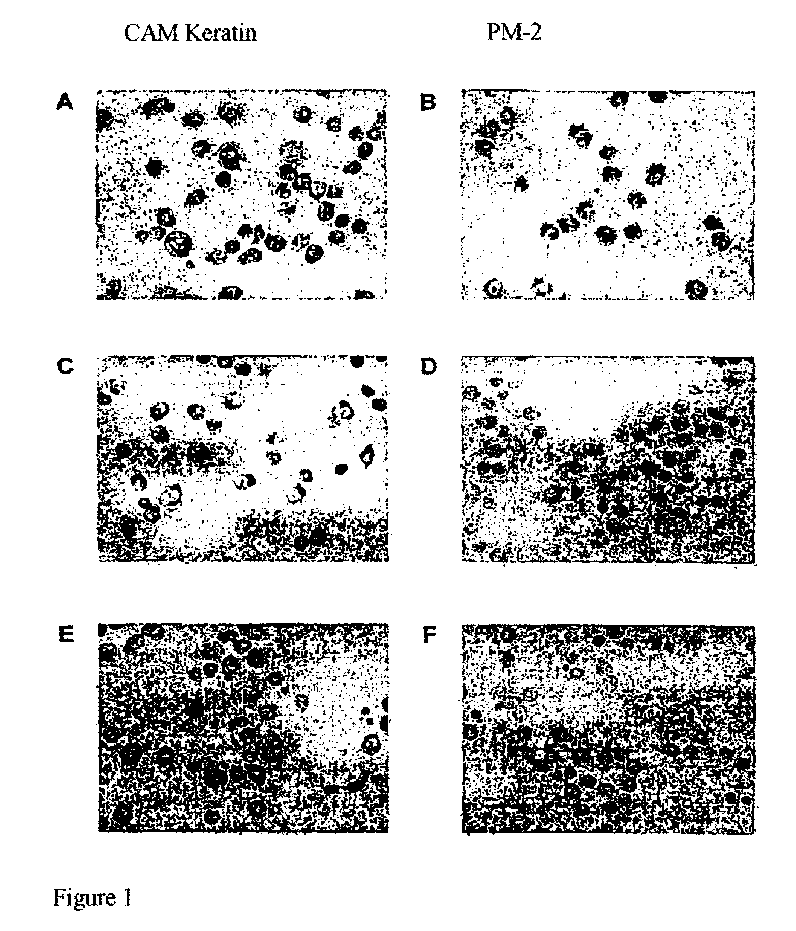 Antigen of the Pm-2 Antibody and Use Thereof