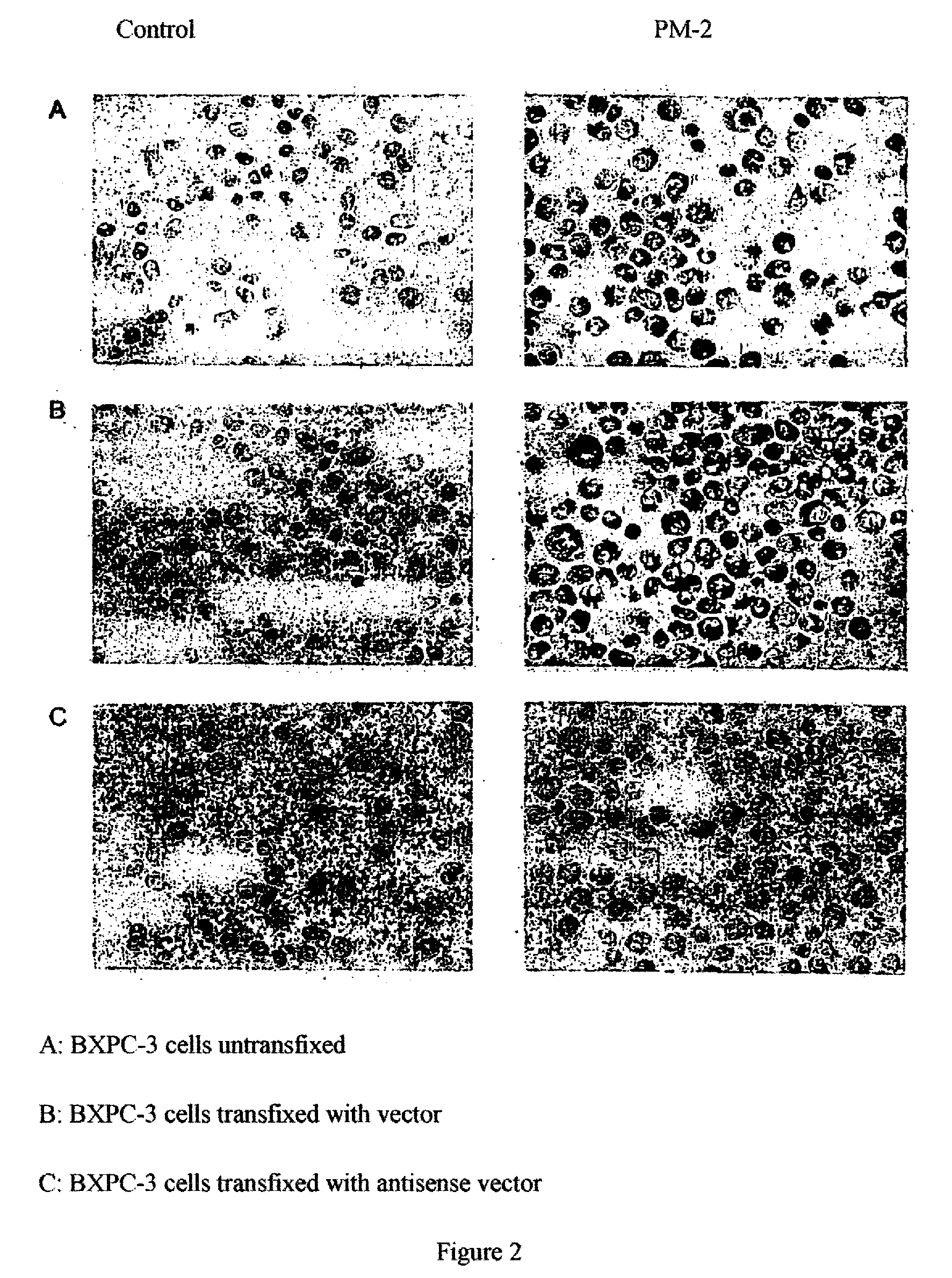 Antigen of the Pm-2 Antibody and Use Thereof