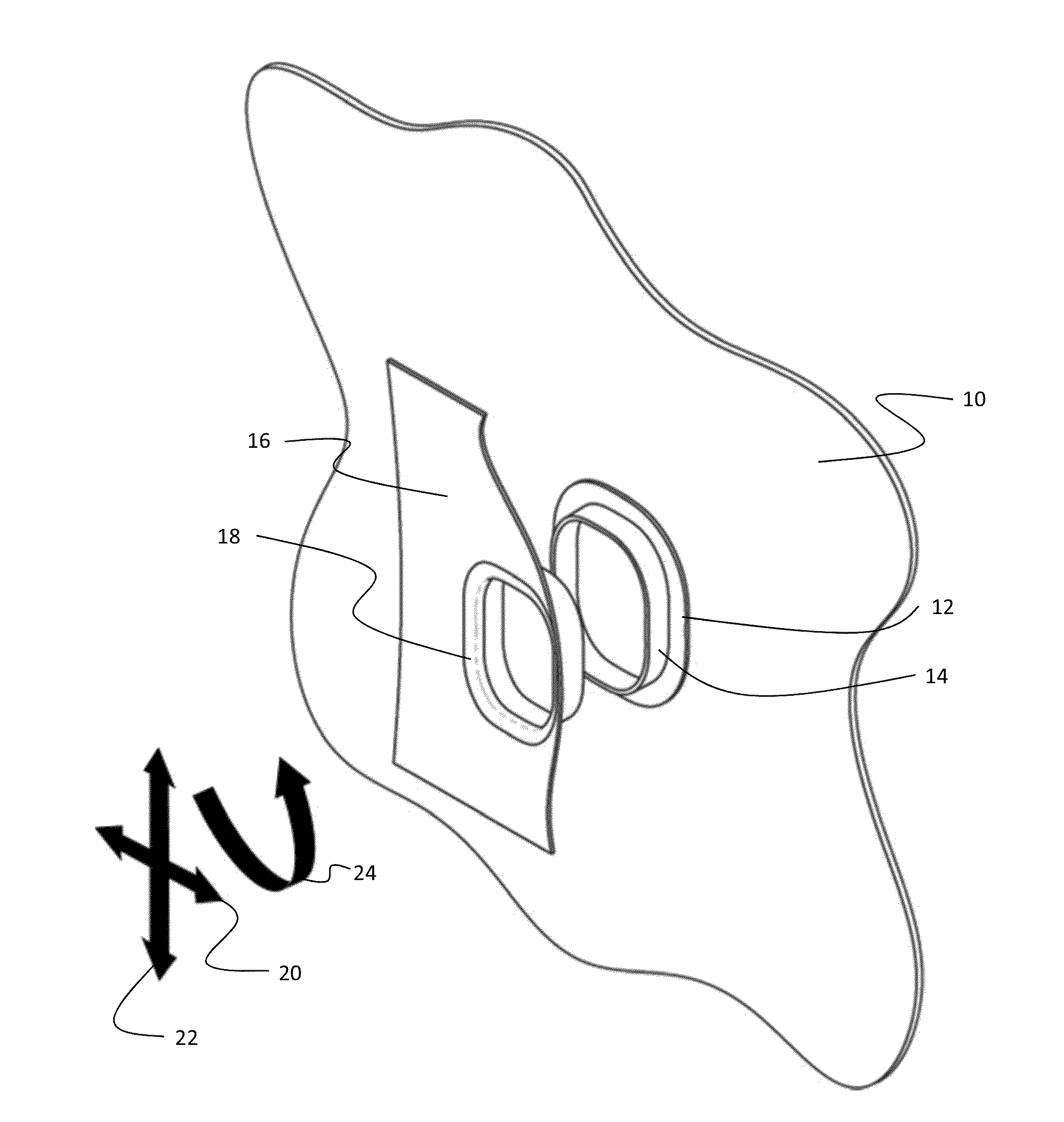 Decorative ring device for free-floating interface of aircraft interior sidewall window lining