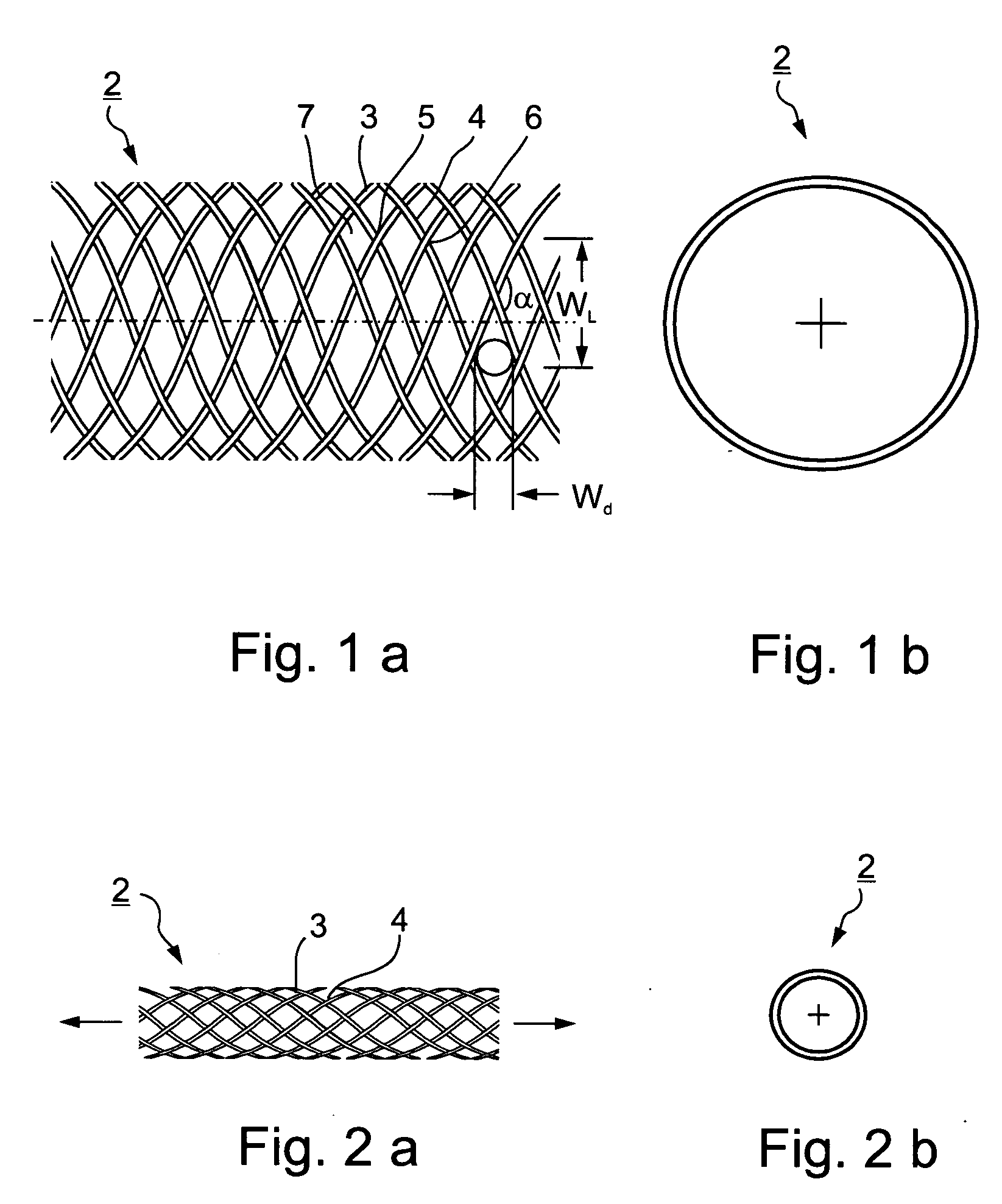 Implantable intraluminal device and method of using same in treating aneurysms