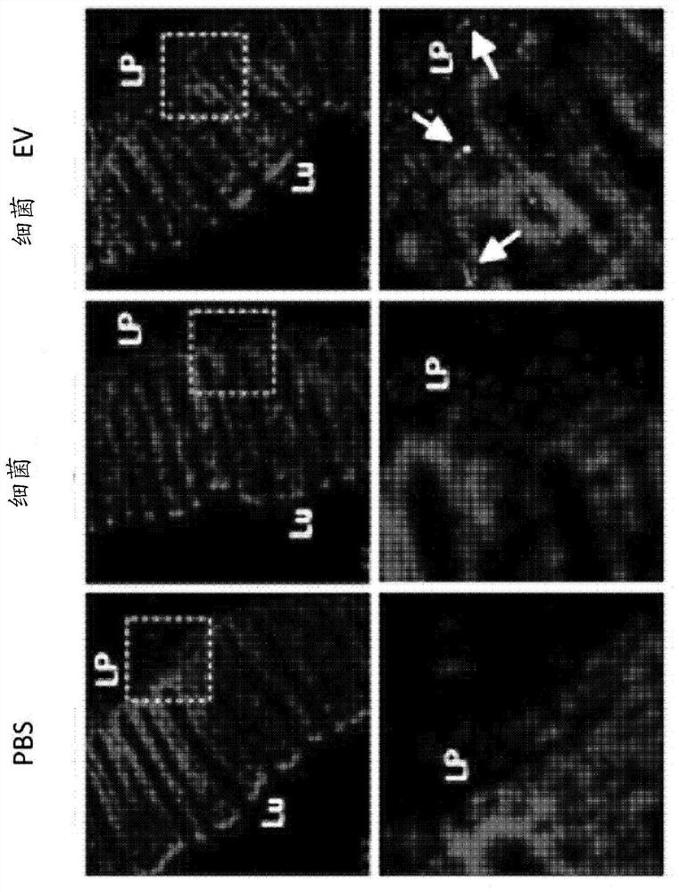 Nanovesicles derived from bacteria of genus deinococcus, and use thereof