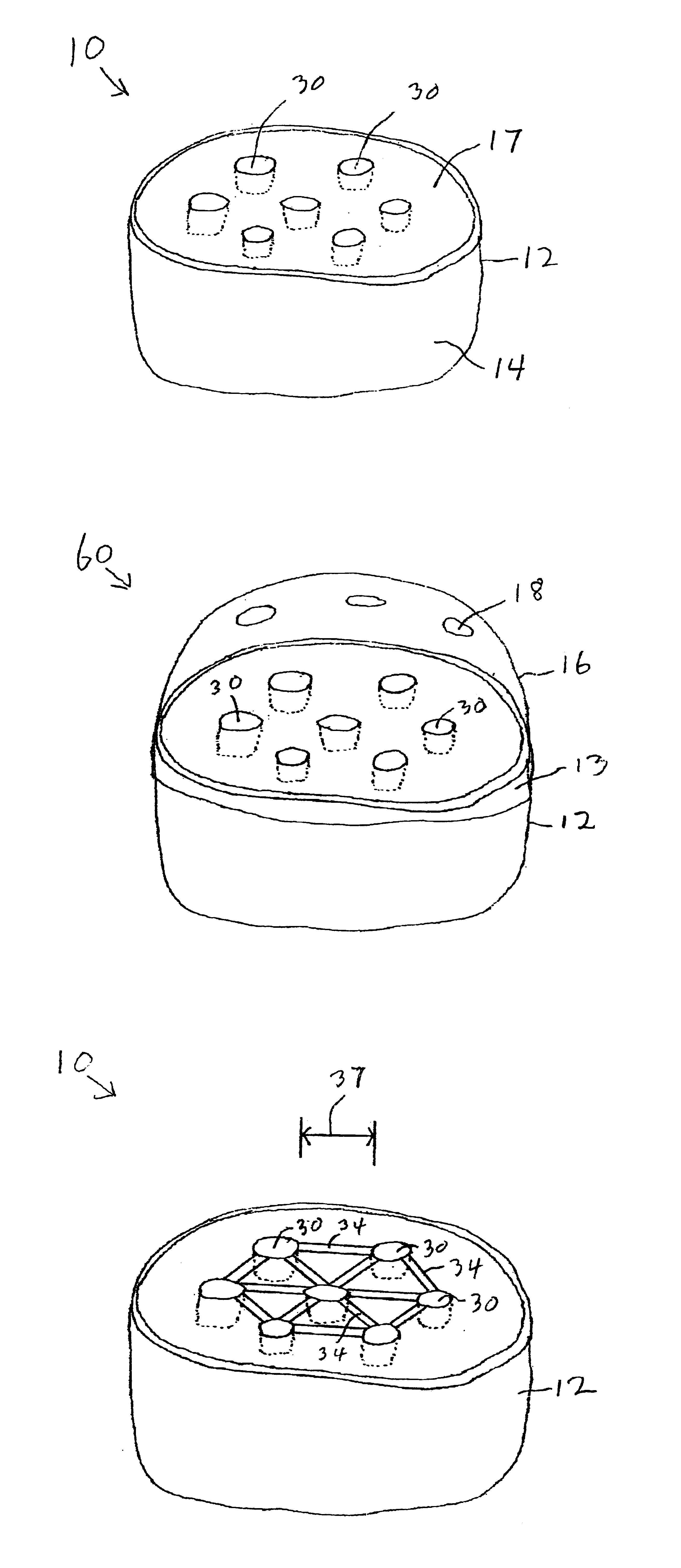 Planting system