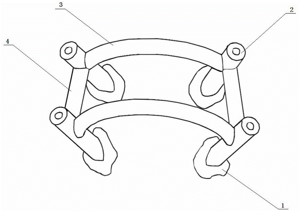 Individualized guiding template assisting in setting pedicle screw into small incision and manufacturing method of individualized guiding template