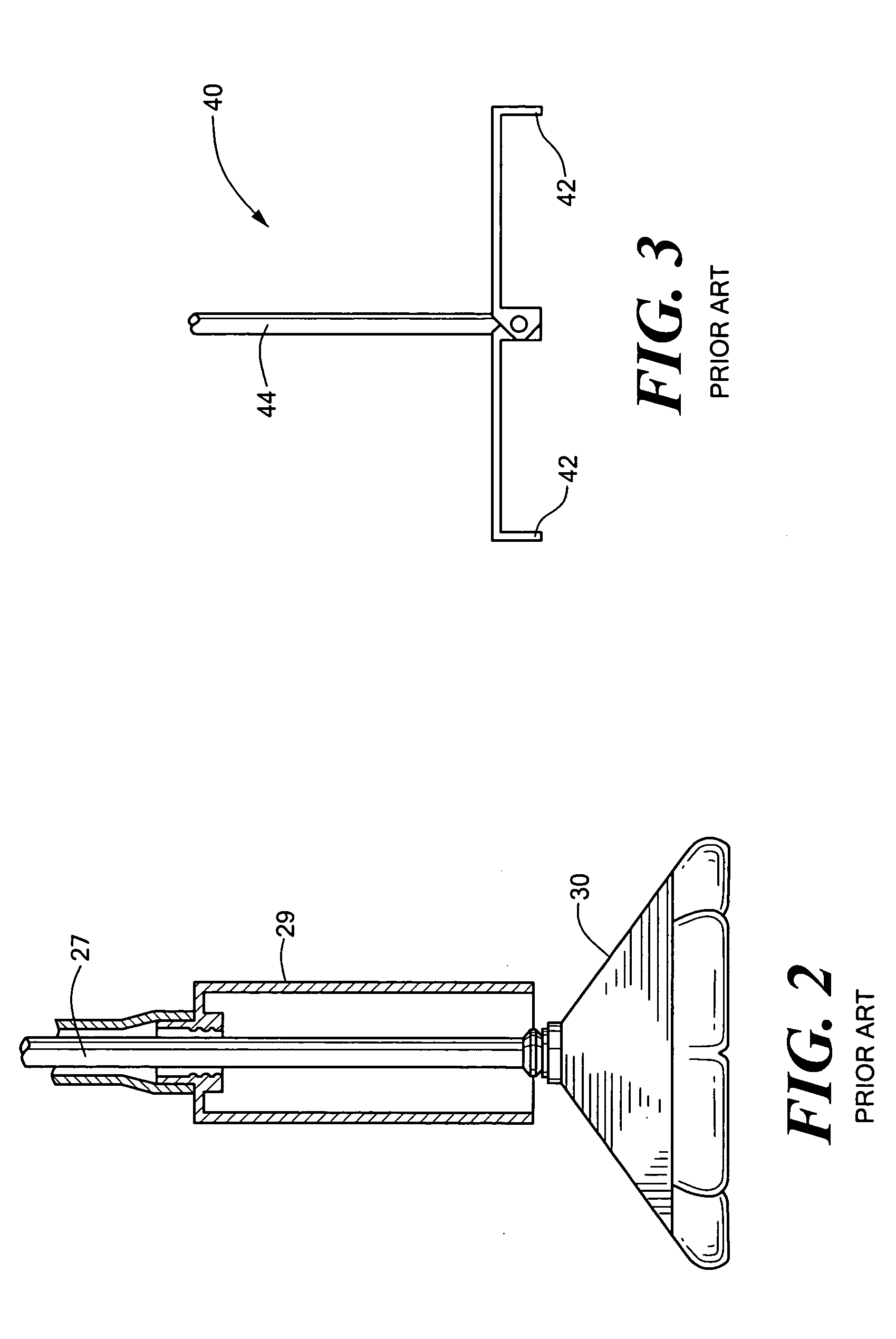 Endovascular tissue removal device