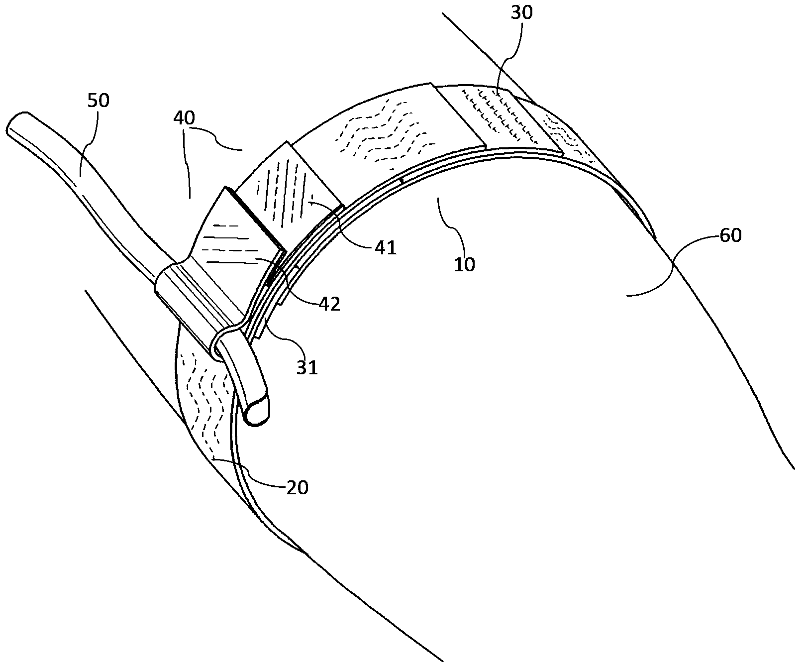 Catheter fixing device