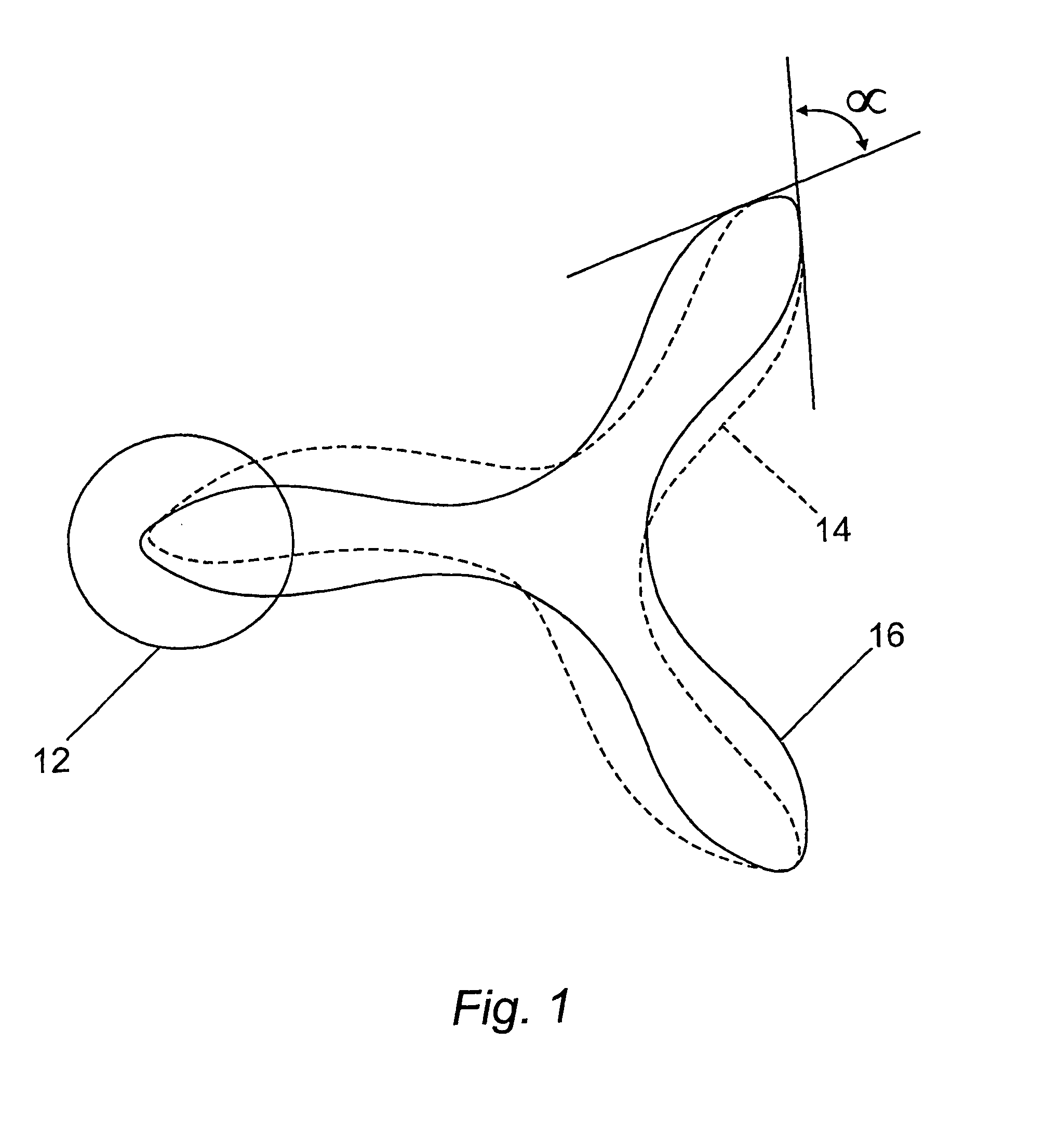 Heart valve prosthesis and method of manufacture