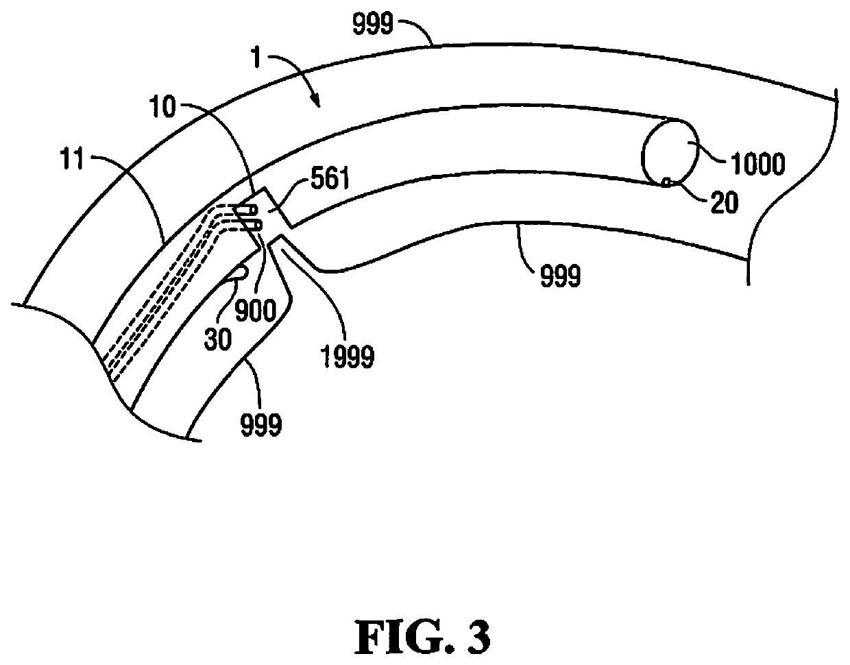 Osteotomy device