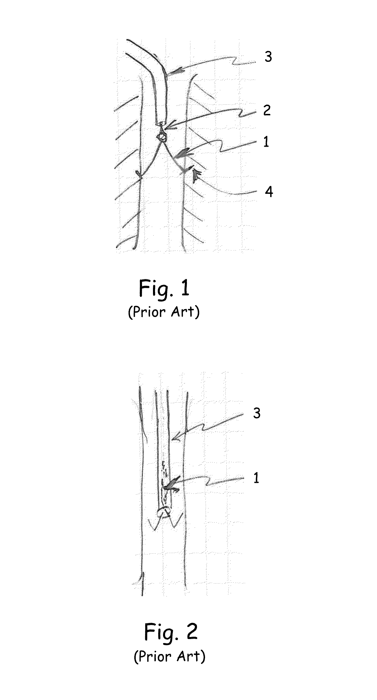 Multi lumen IVC filter retrieval device