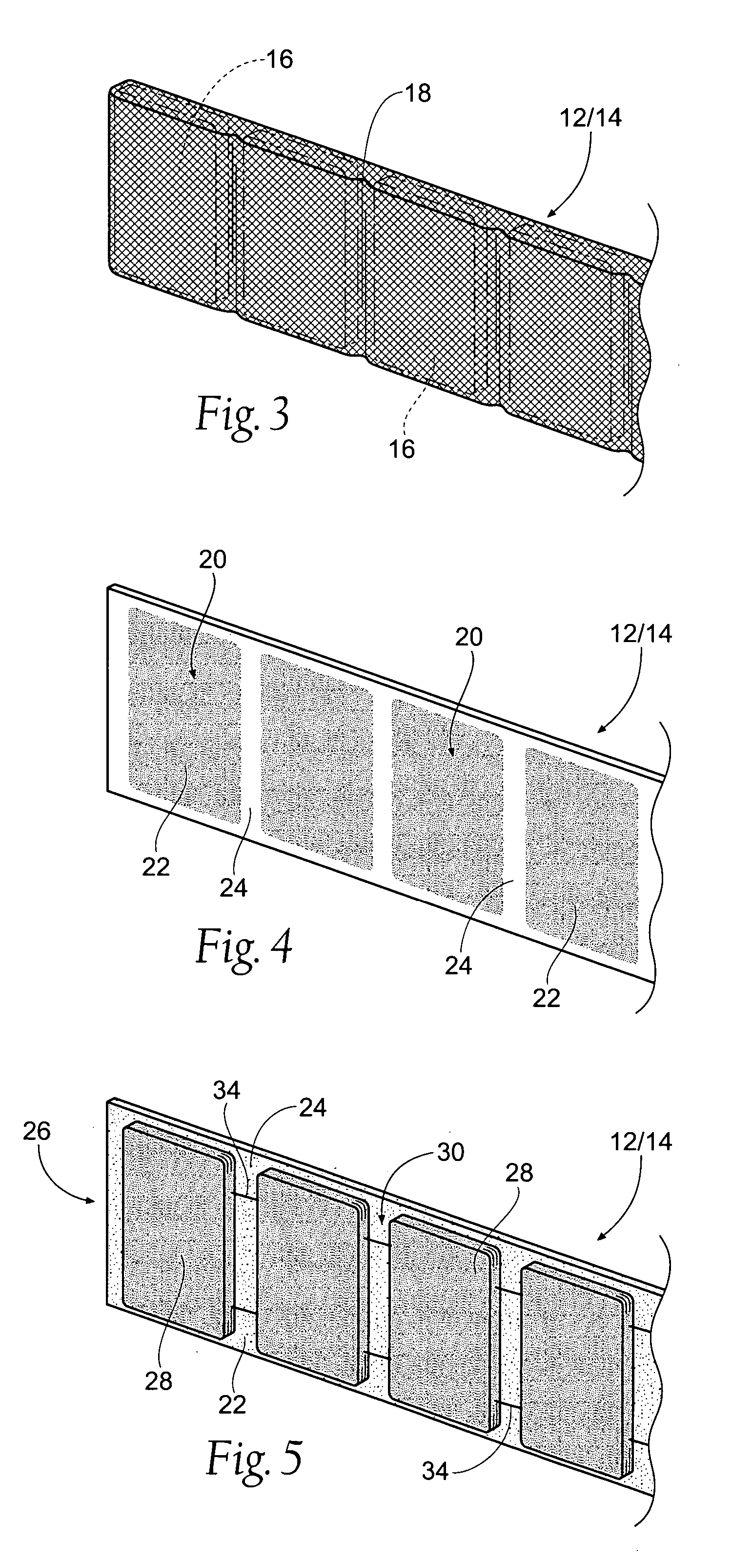 Devices, systems, and methods to fixate tissue within the regions of body, such as the pharyngeal conduit