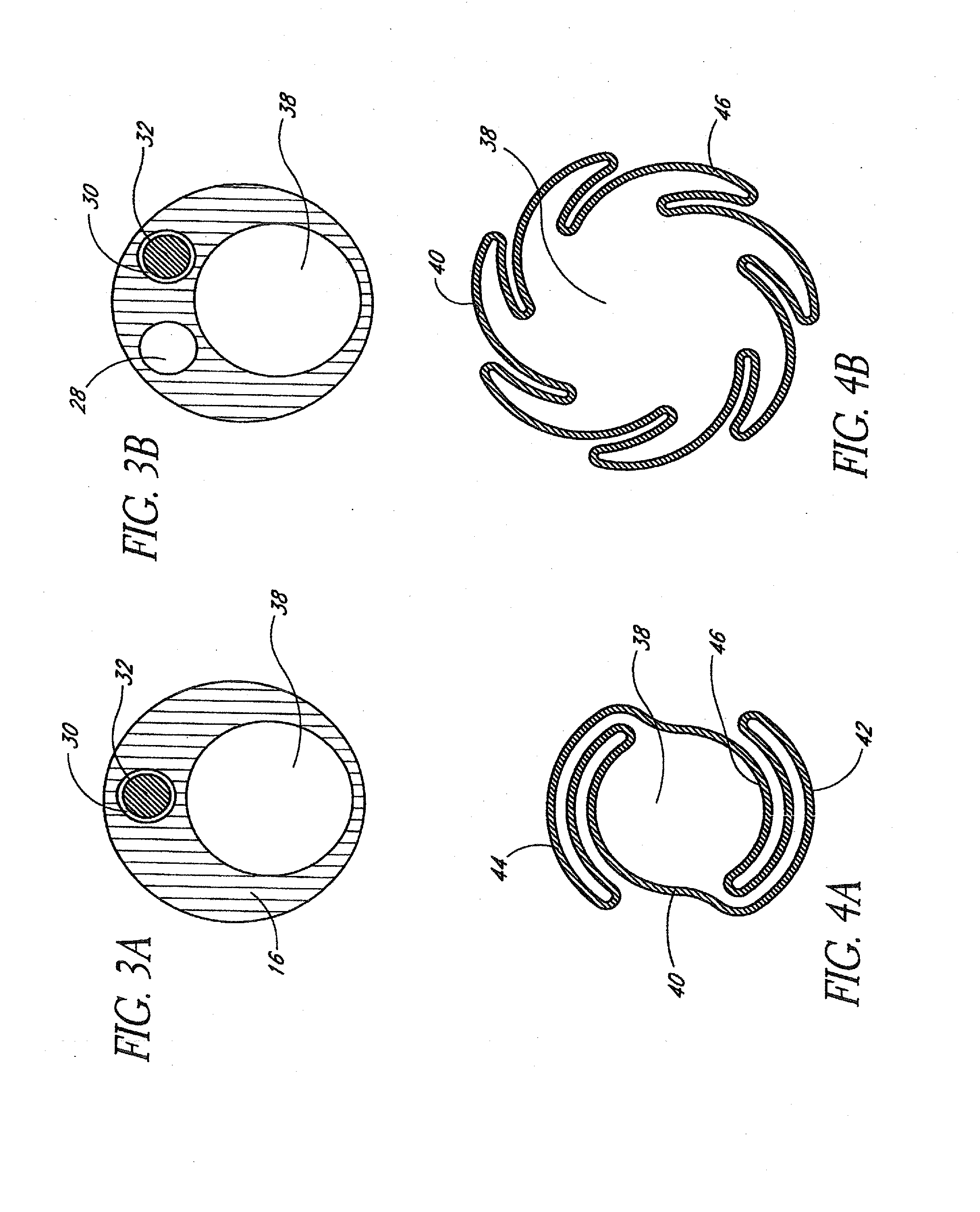 Systems and methods for removing obstructive matter from body lumens and treating vascular defects