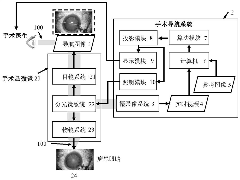 Ophthalmic surgery navigation system