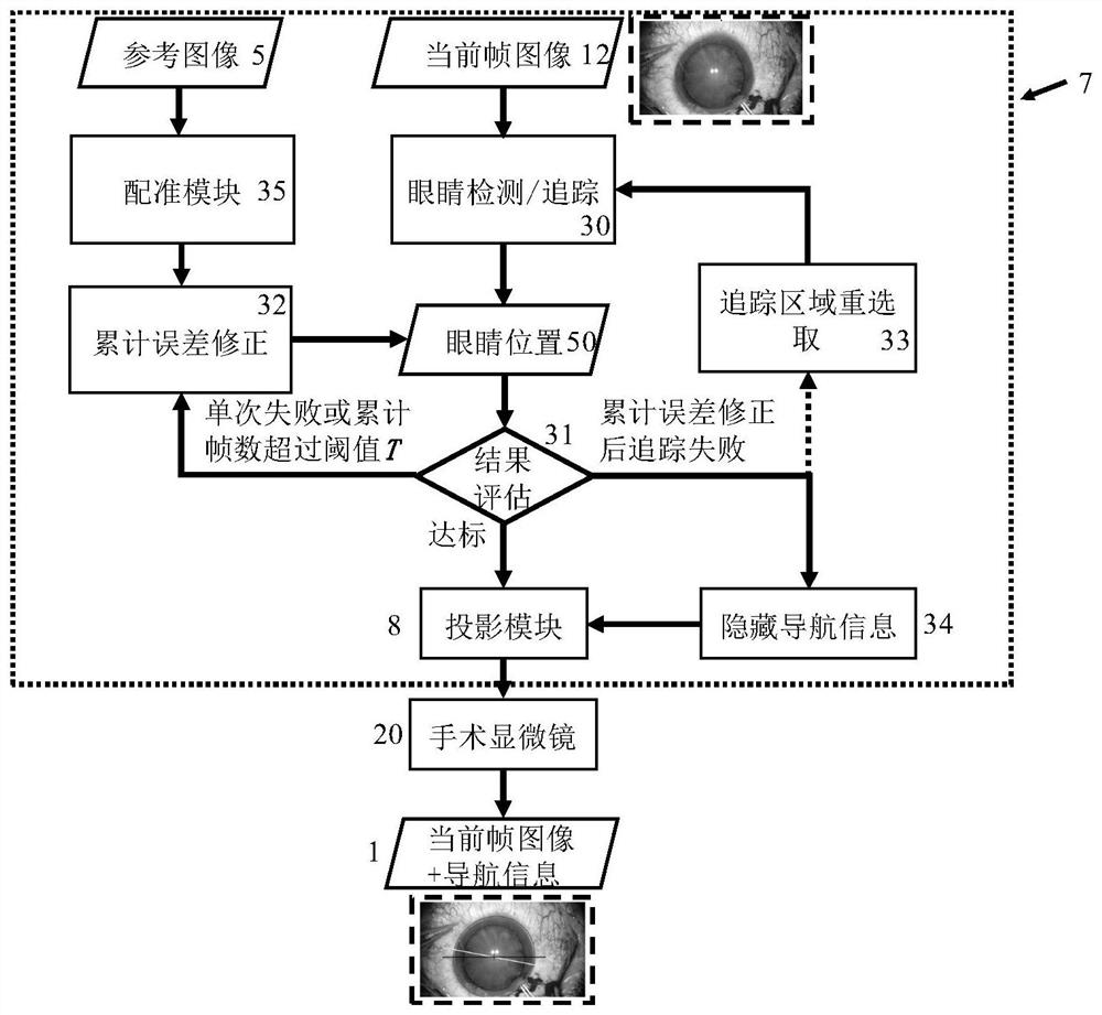 Ophthalmic surgery navigation system