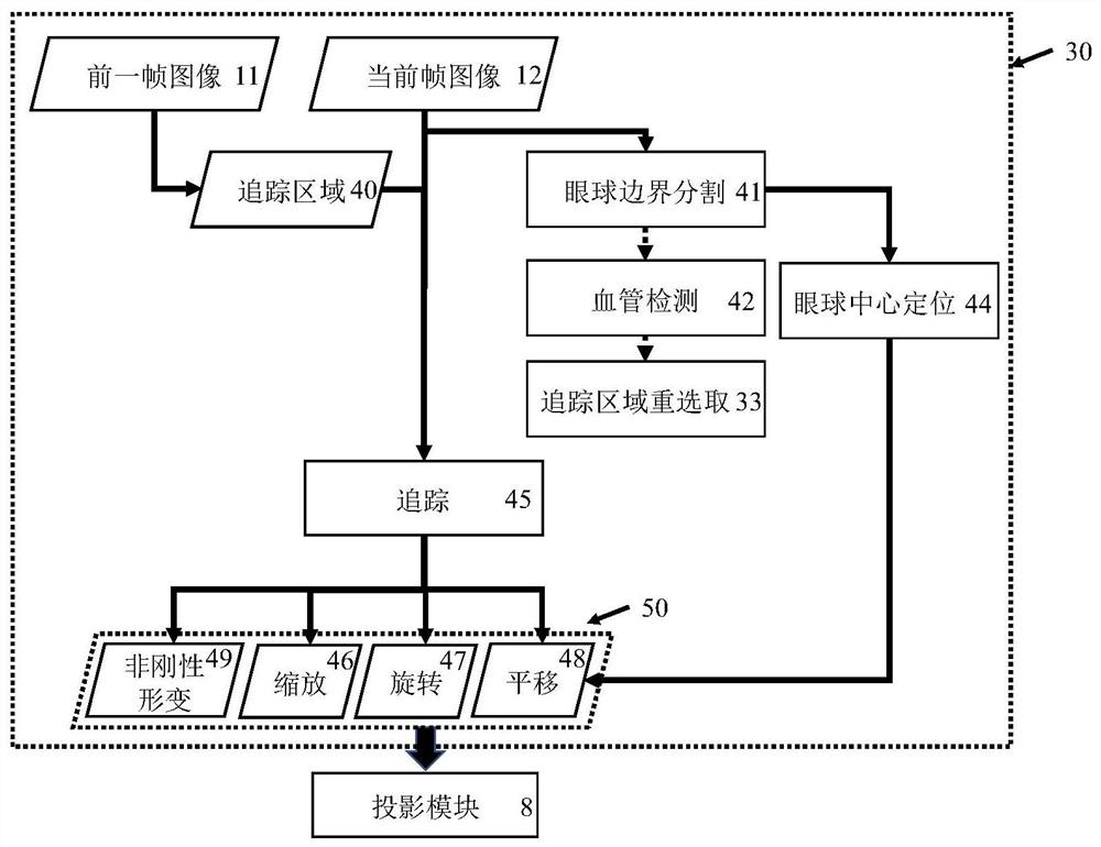 Ophthalmic surgery navigation system