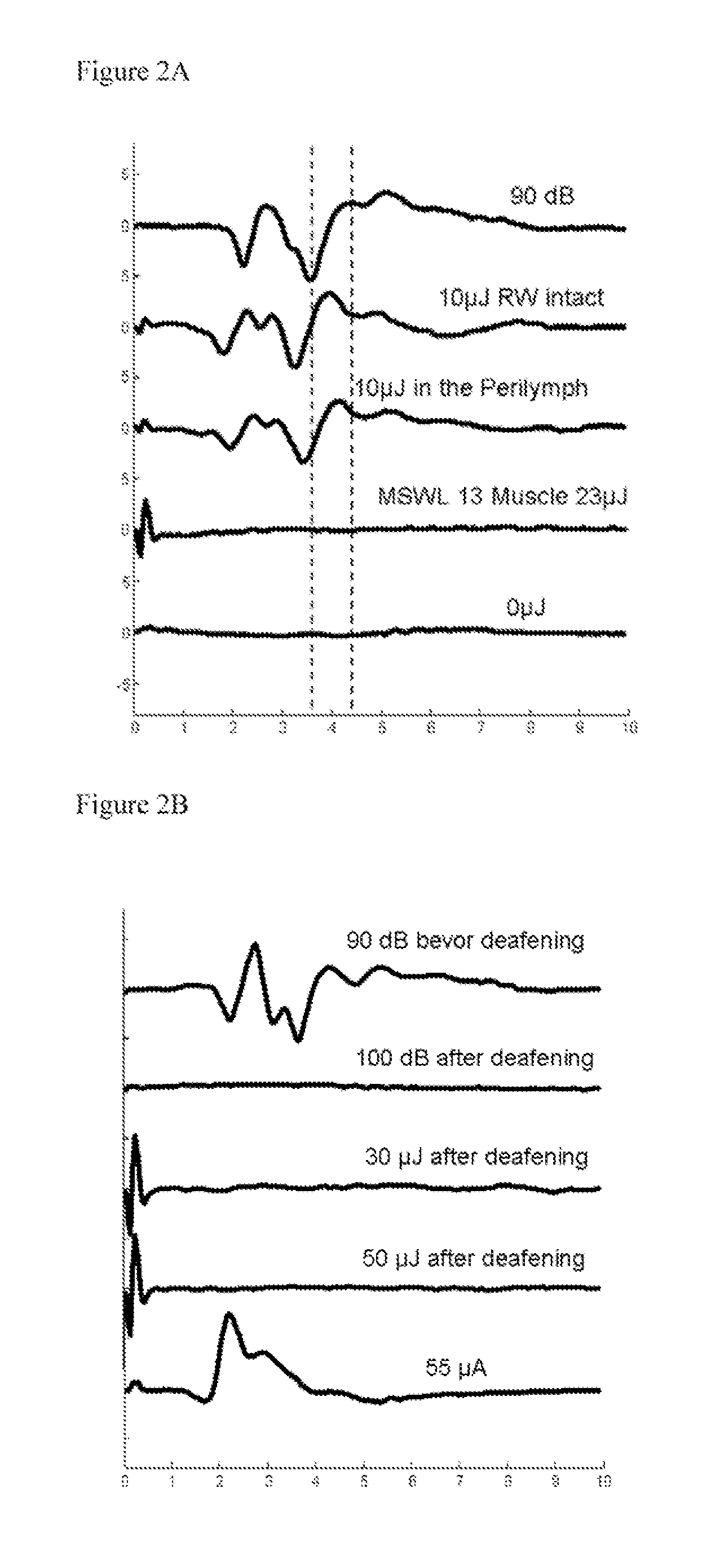 Cochlea stimulator