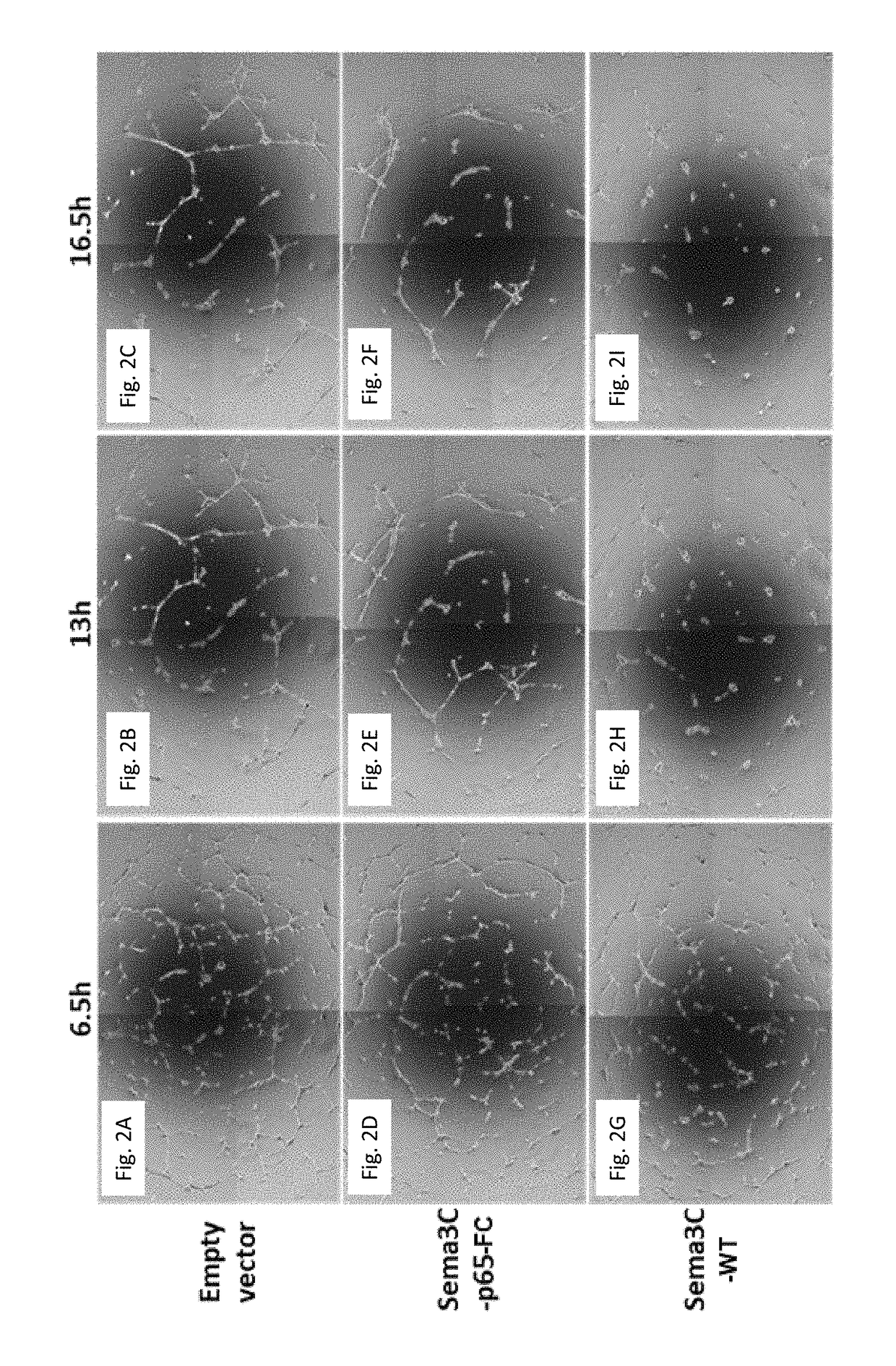 Semaphorin 3c variants, compositions comprising said variants and methods of use thereof in treating eye diseases