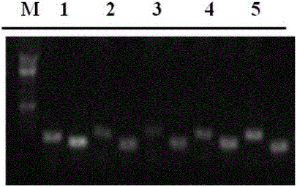 Optimized glutamine transaminase gene and leader sequence as well as secretory expression thereof