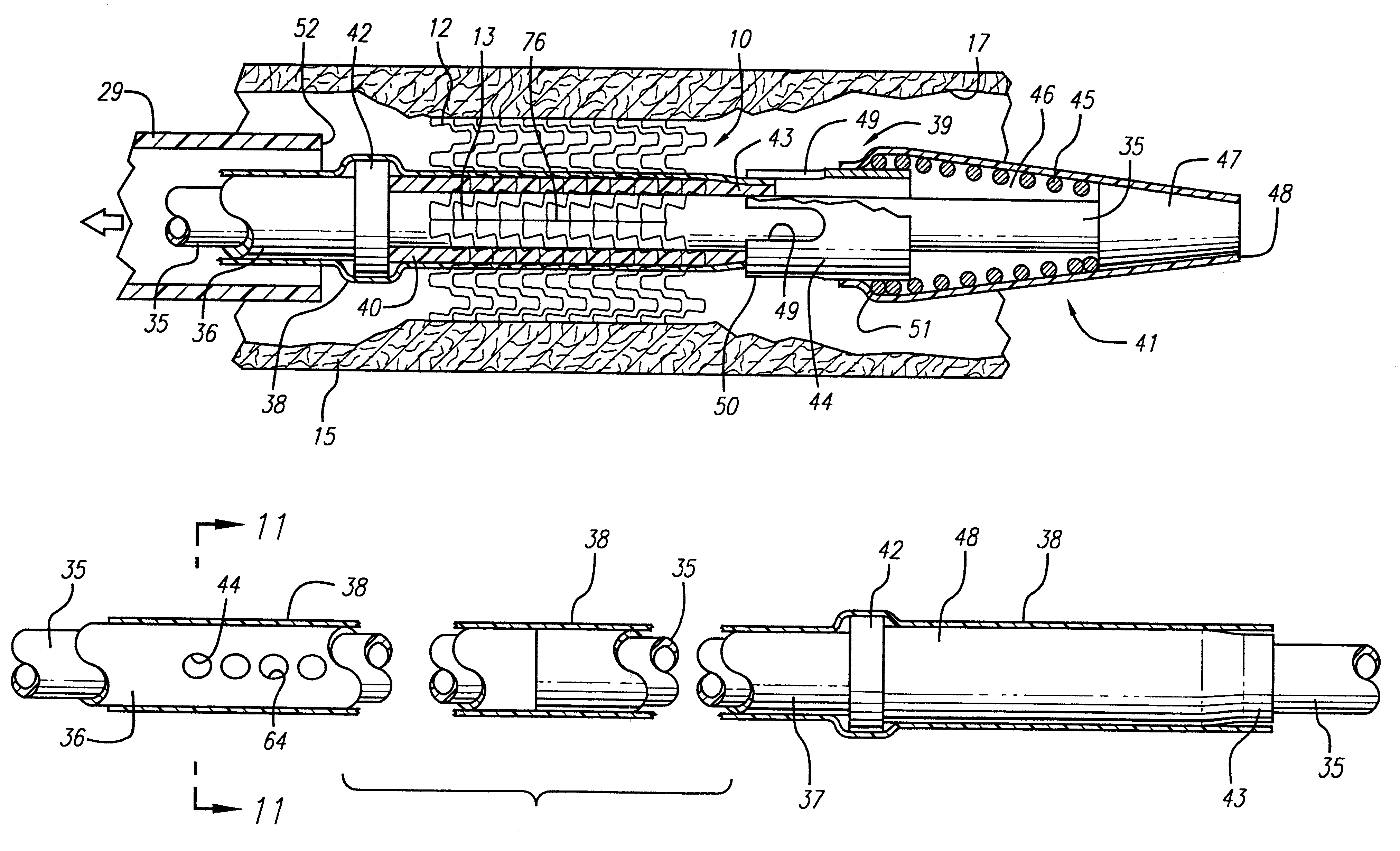 Self-expanding stent with enhanced delivery precision and stent delivery system