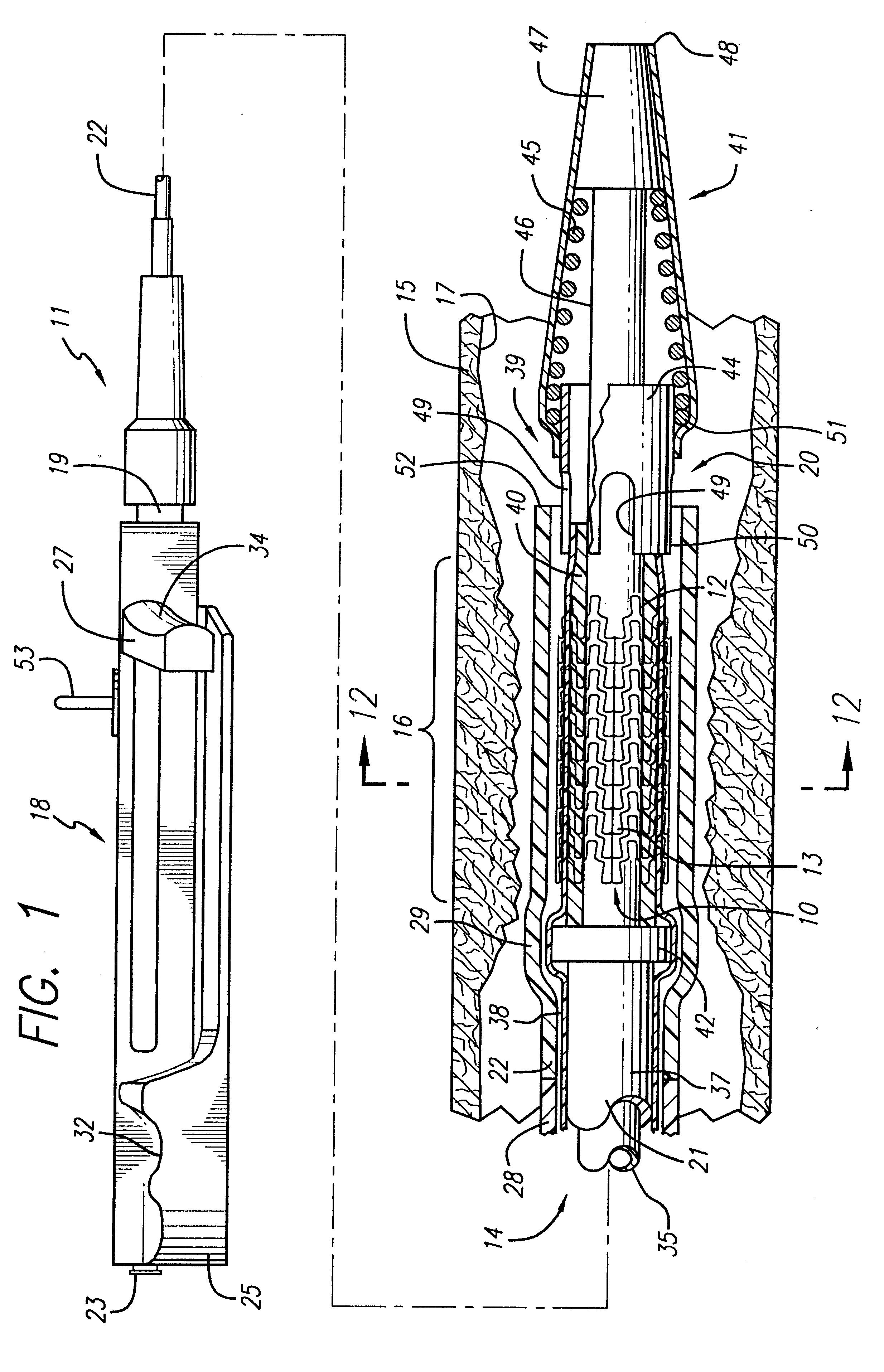 Self-expanding stent with enhanced delivery precision and stent delivery system