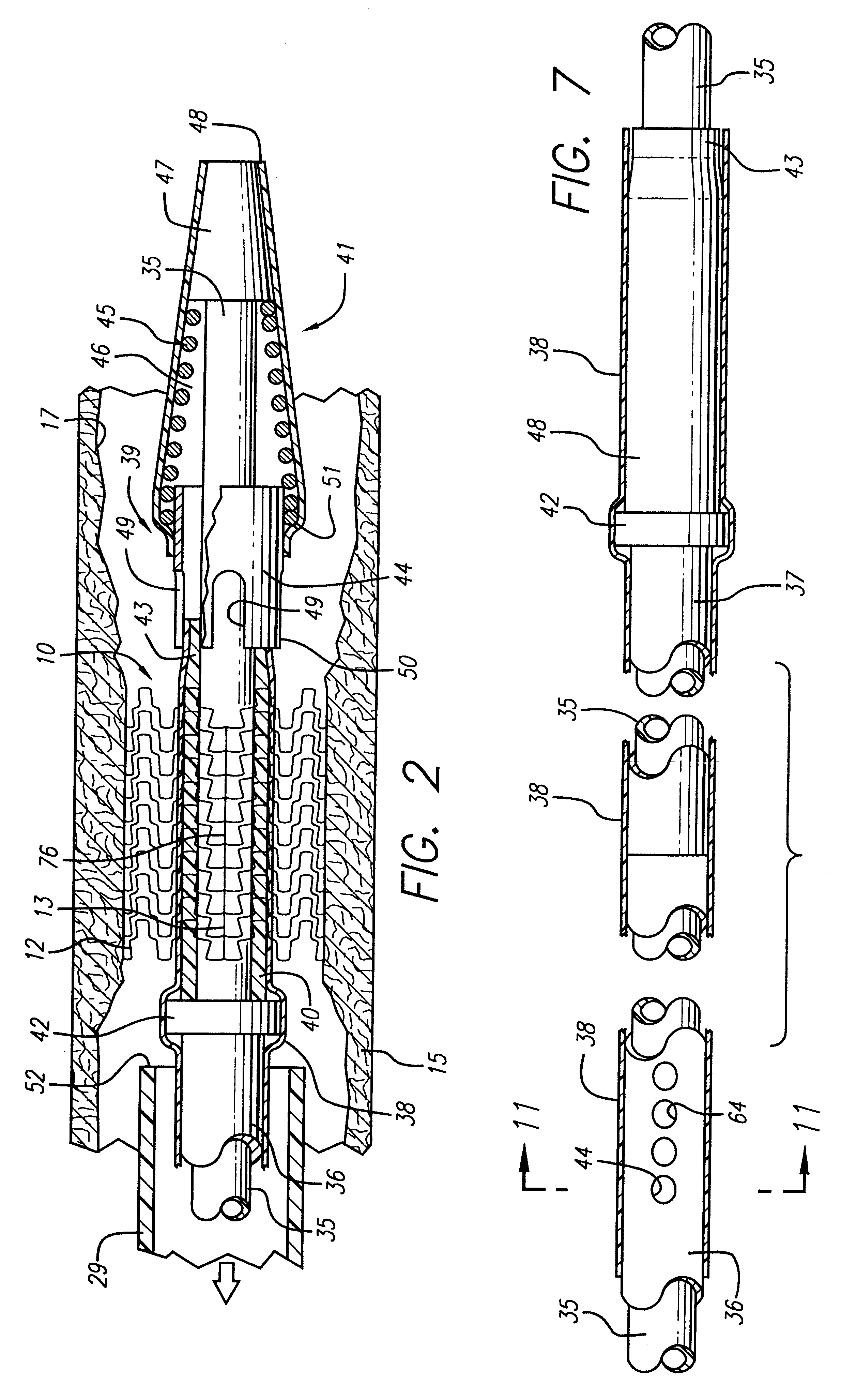 Self-expanding stent with enhanced delivery precision and stent delivery system