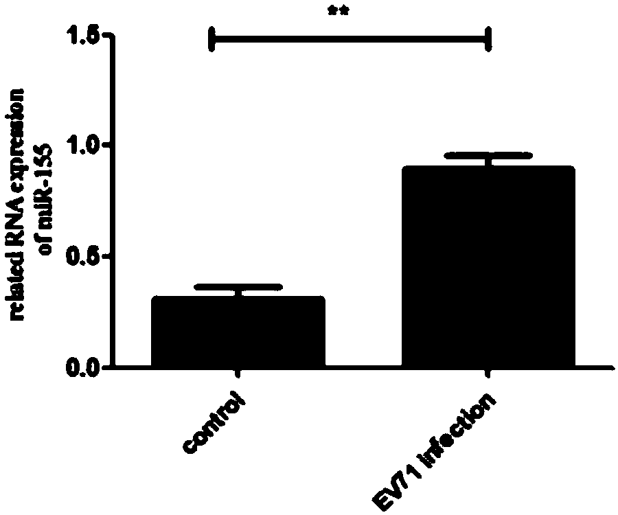 Application of hsa-miRNA-155-5p for preparing medicine for inhibiting human enterovirus 71