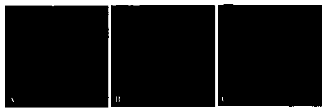 Method of inducing differentiation of neural stem cell into dopaminergic neuron by using recombinant slow virus