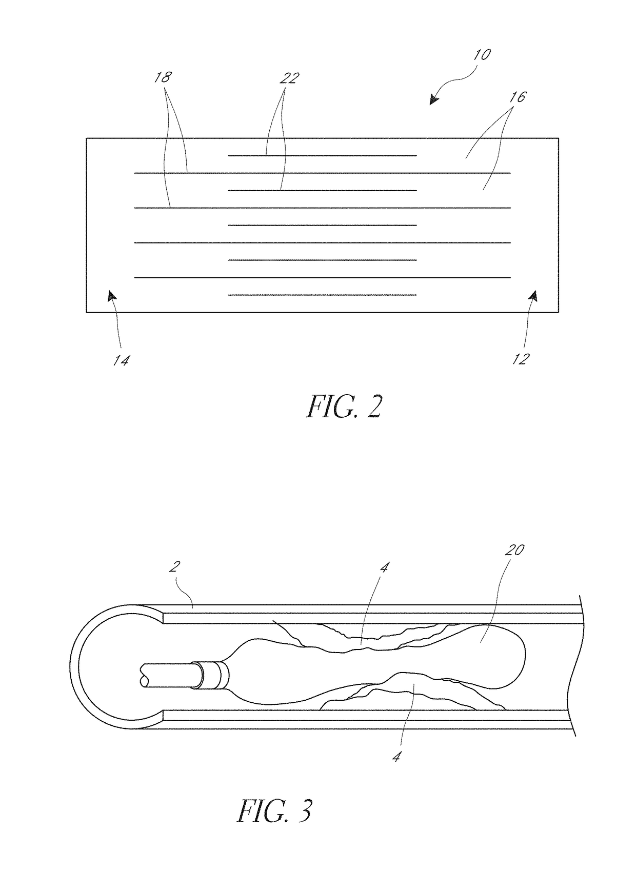 Wedge dissectors for a medical balloon