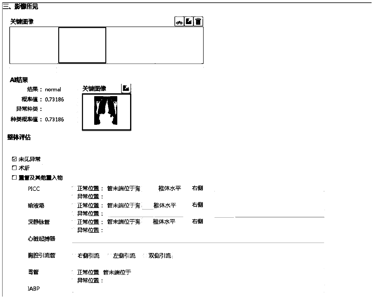 Chest X-ray image intelligent diagnosis system and diagnosis method thereof