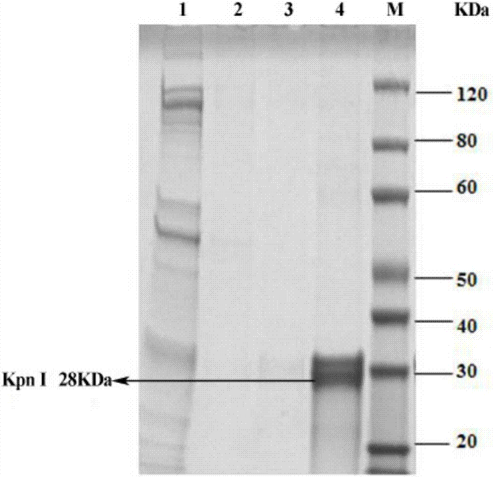 Method for efficient recombinant expression of restriction endonuclease