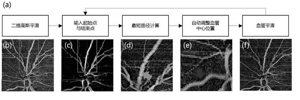 Method of imaging of in vivo retina haemodynamics and measuring of absolute flow velocity