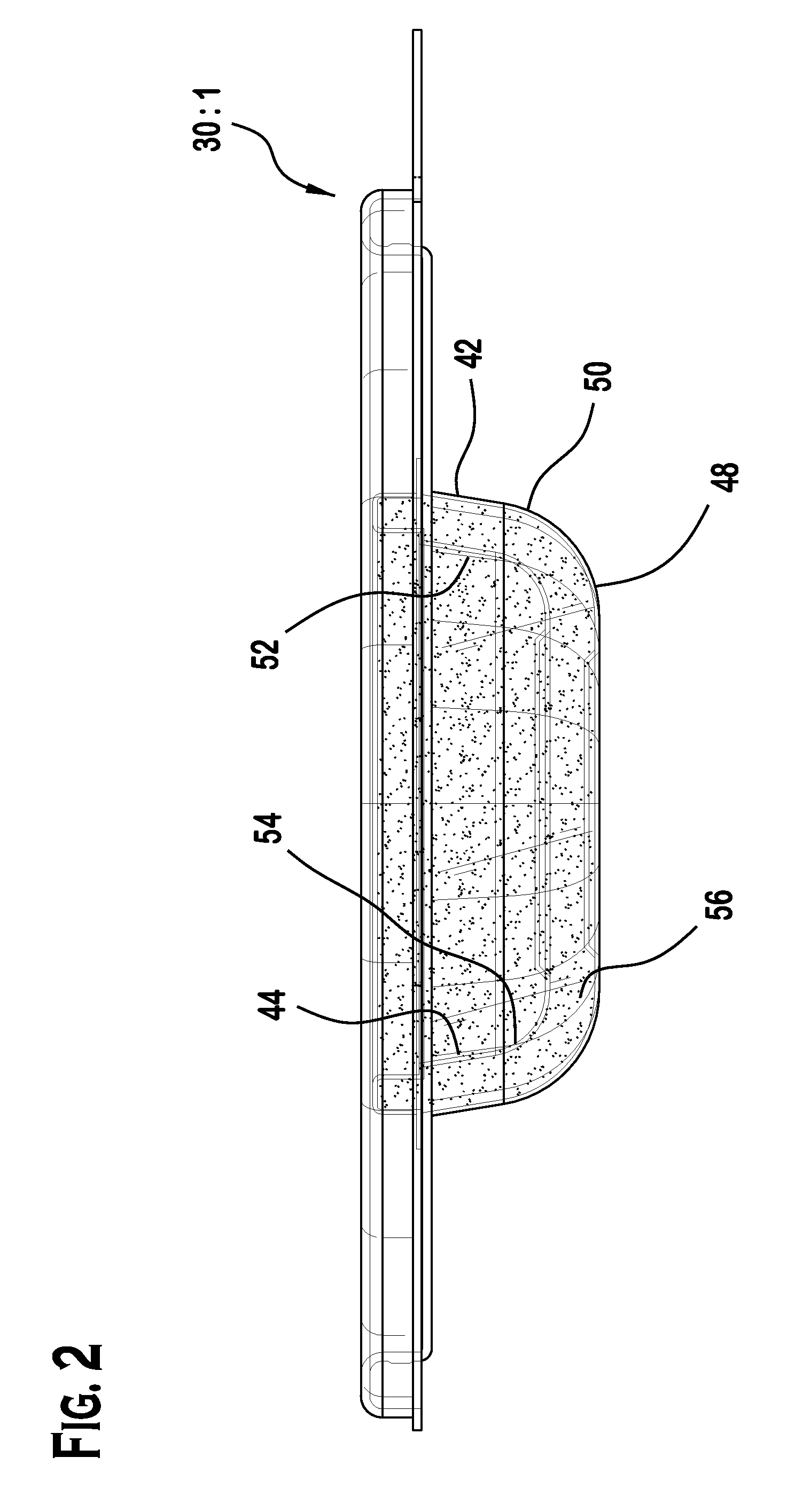 Food storage system