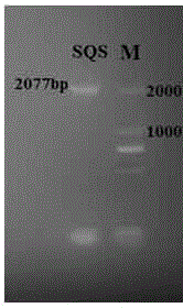 High-yield engineering strain kmust-SQS for ganoderic acid