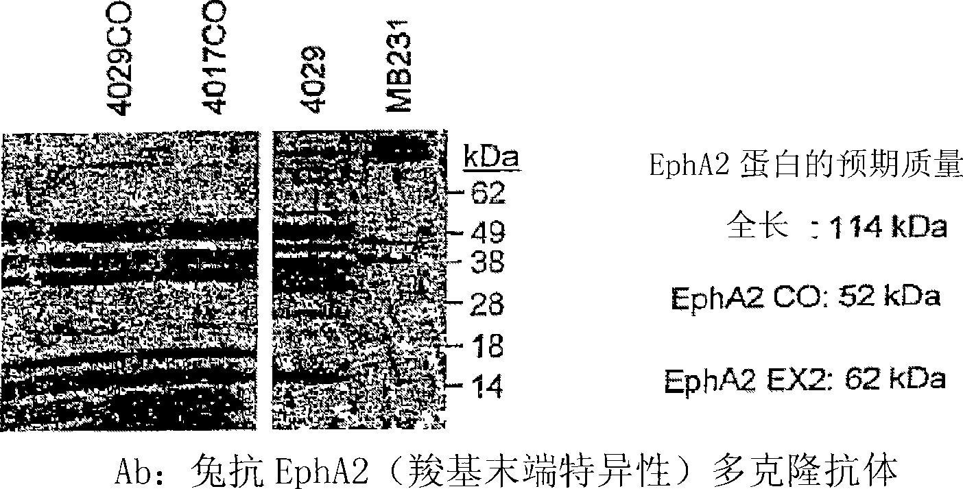 Listeria-based EphA2 vaccines