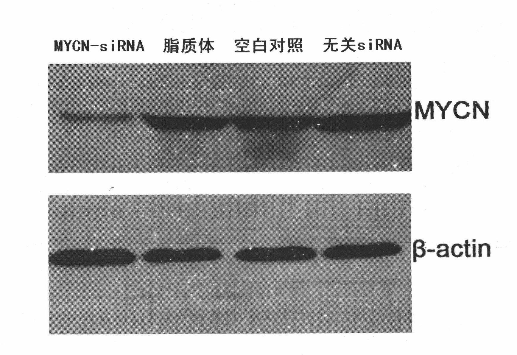 Novel folate receptor targeted liposome