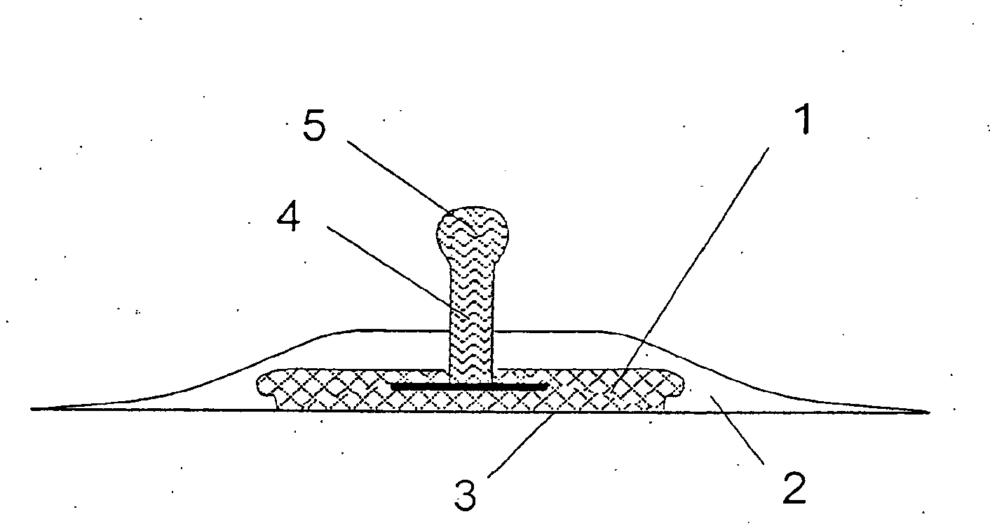 Electrode belt for carrying out electrodiagnostic procedures on the human body