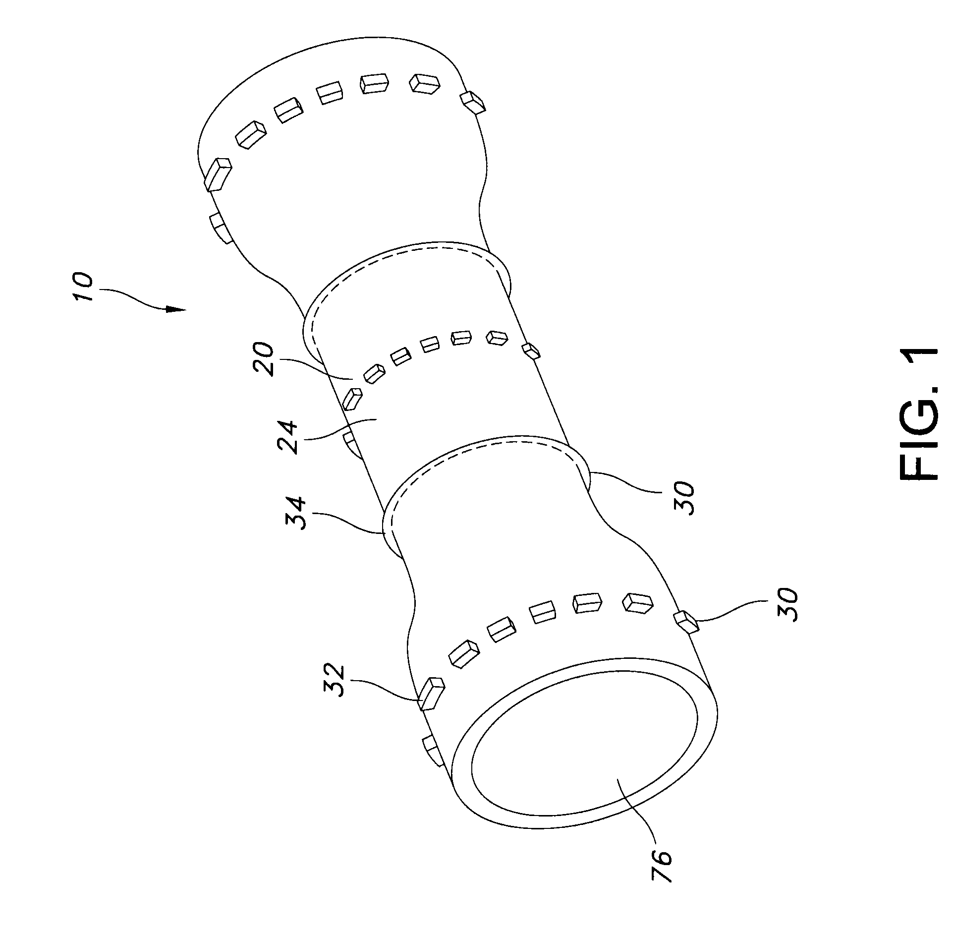 Stent with Anti-migration feature