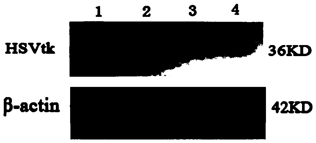 Anti-GOLPH2-lipoplexes liposome carrier as well as preparation and application thereof