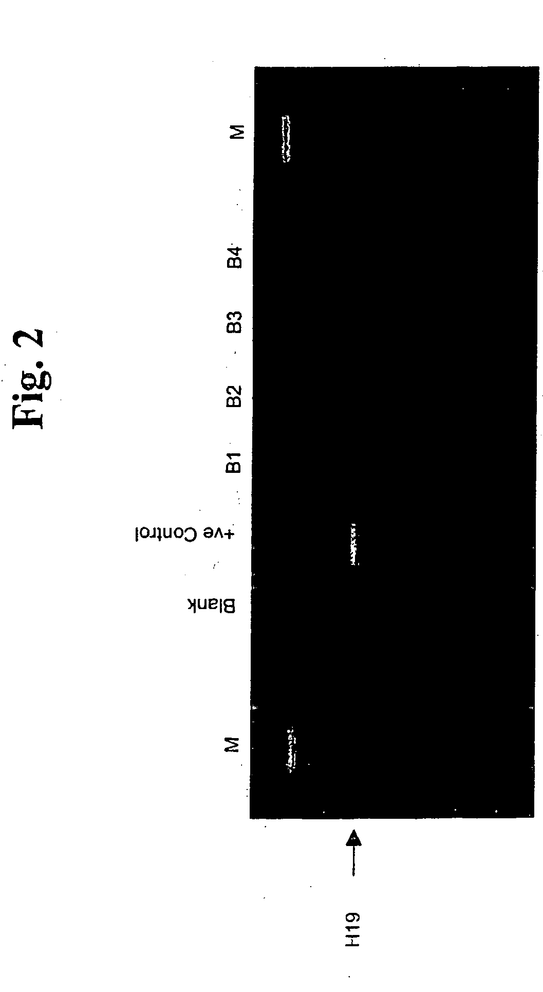 Method for detection of micro-metastasis