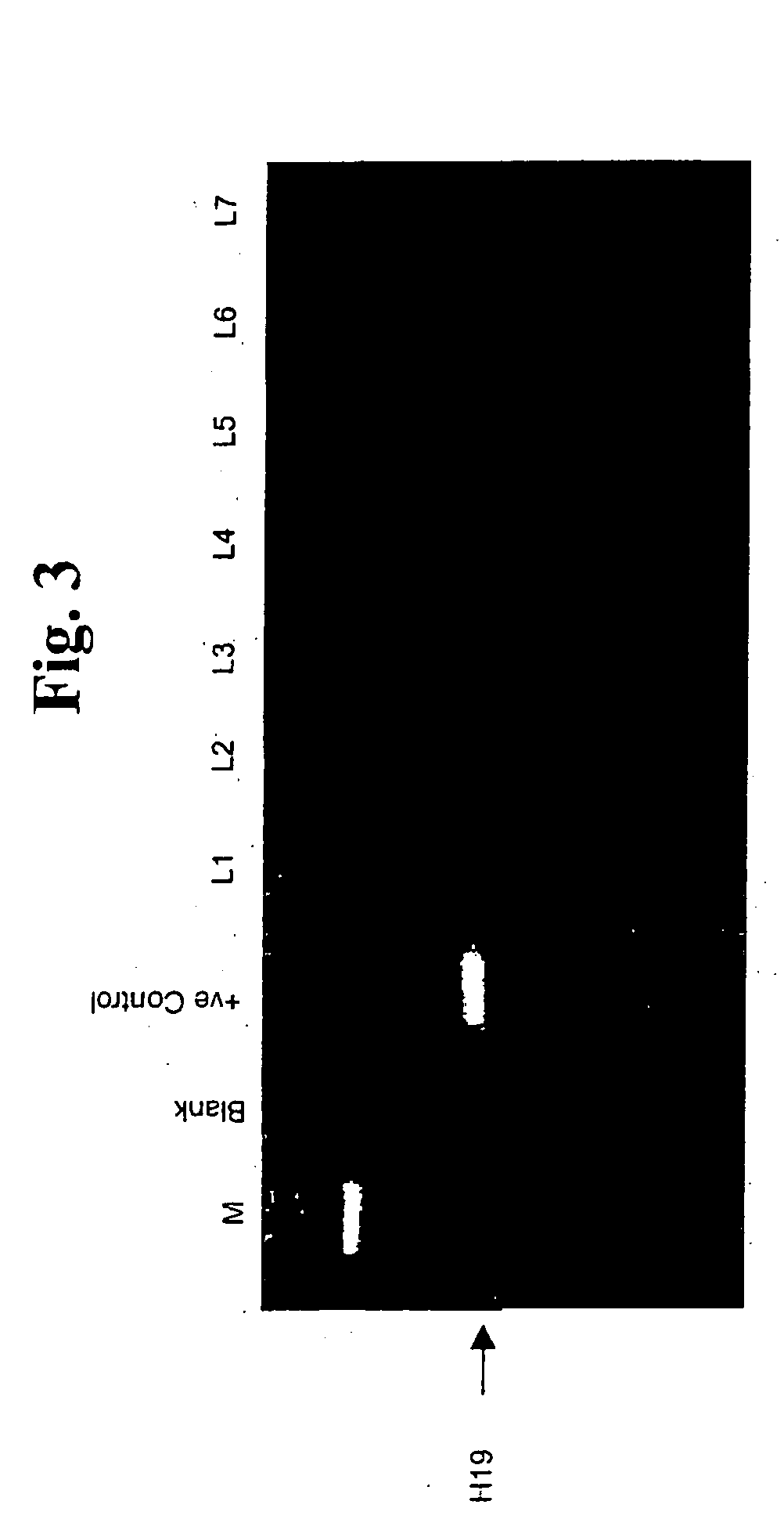 Method for detection of micro-metastasis