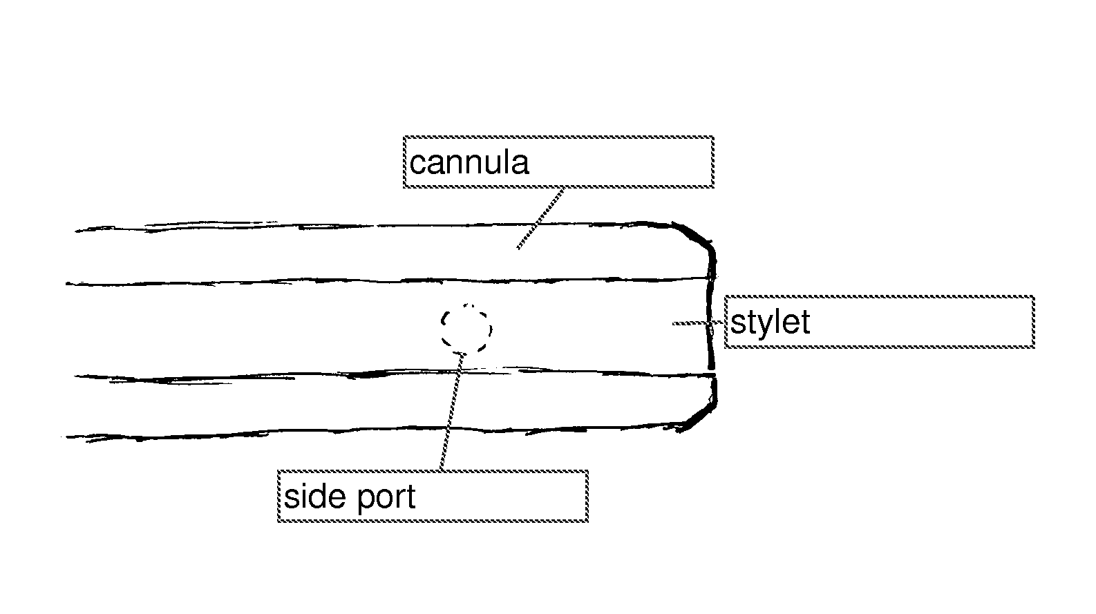 Neural injection system and related methods