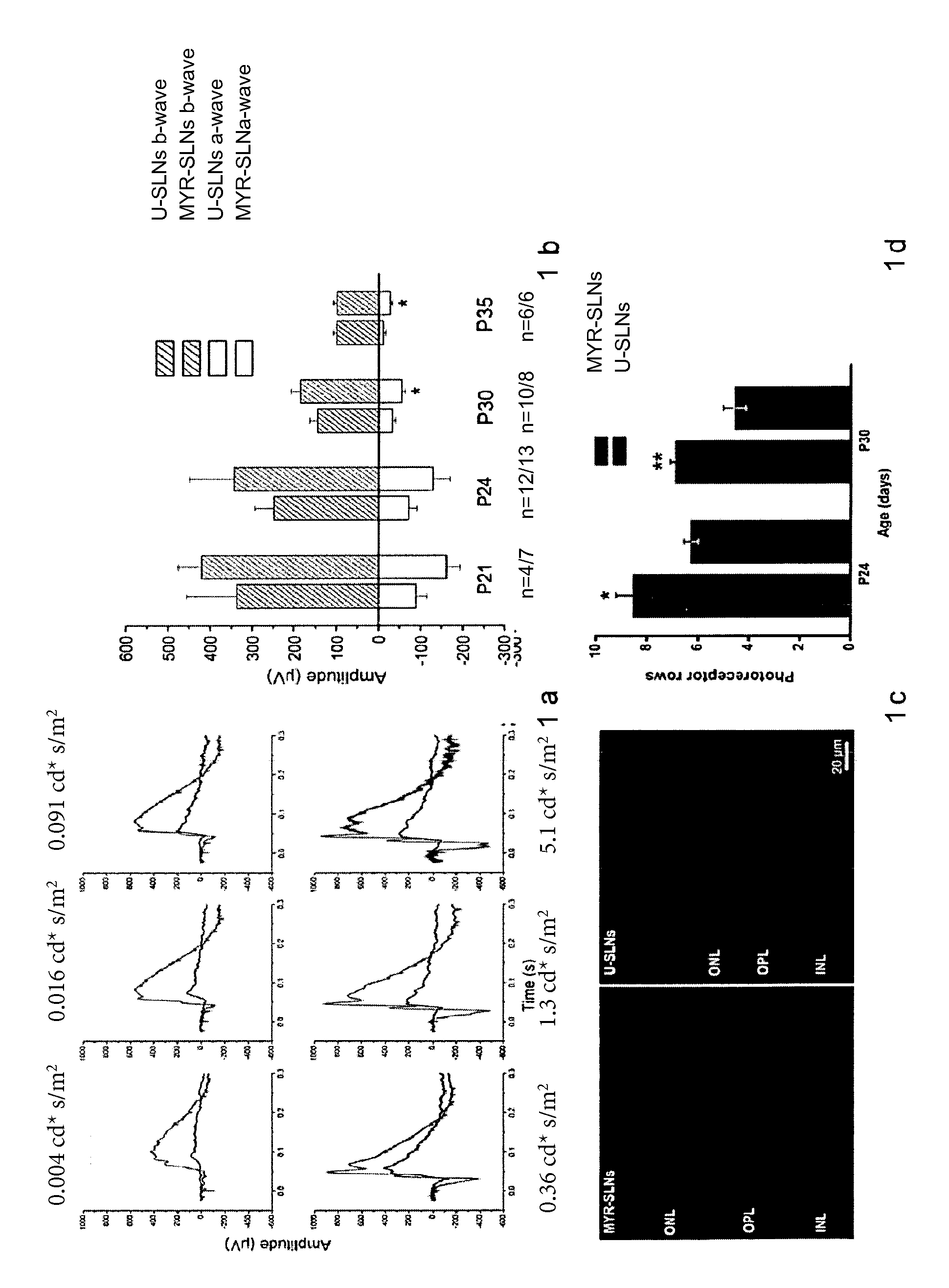 Use of serine palmitoyl transferase inhibitors for preventing and delaying inherited retinal degenerations and compositions thereof