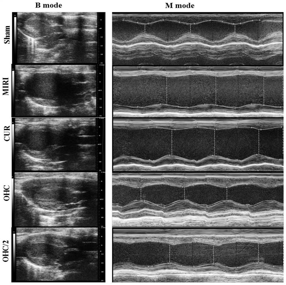 Application of curcumin metabolites in the preparation of drugs for the treatment of myocardial ischemia-related injuries