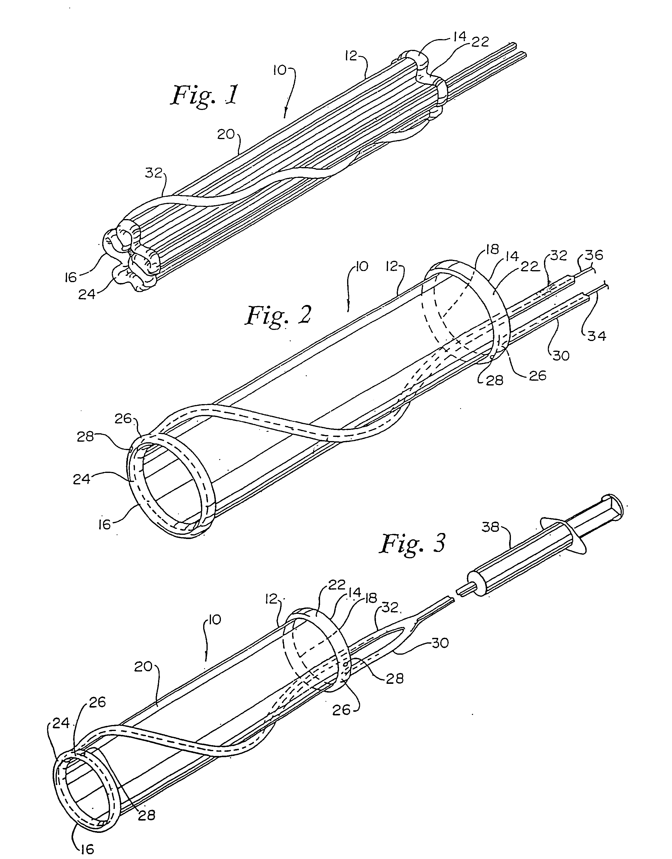 Endovascular apparatus