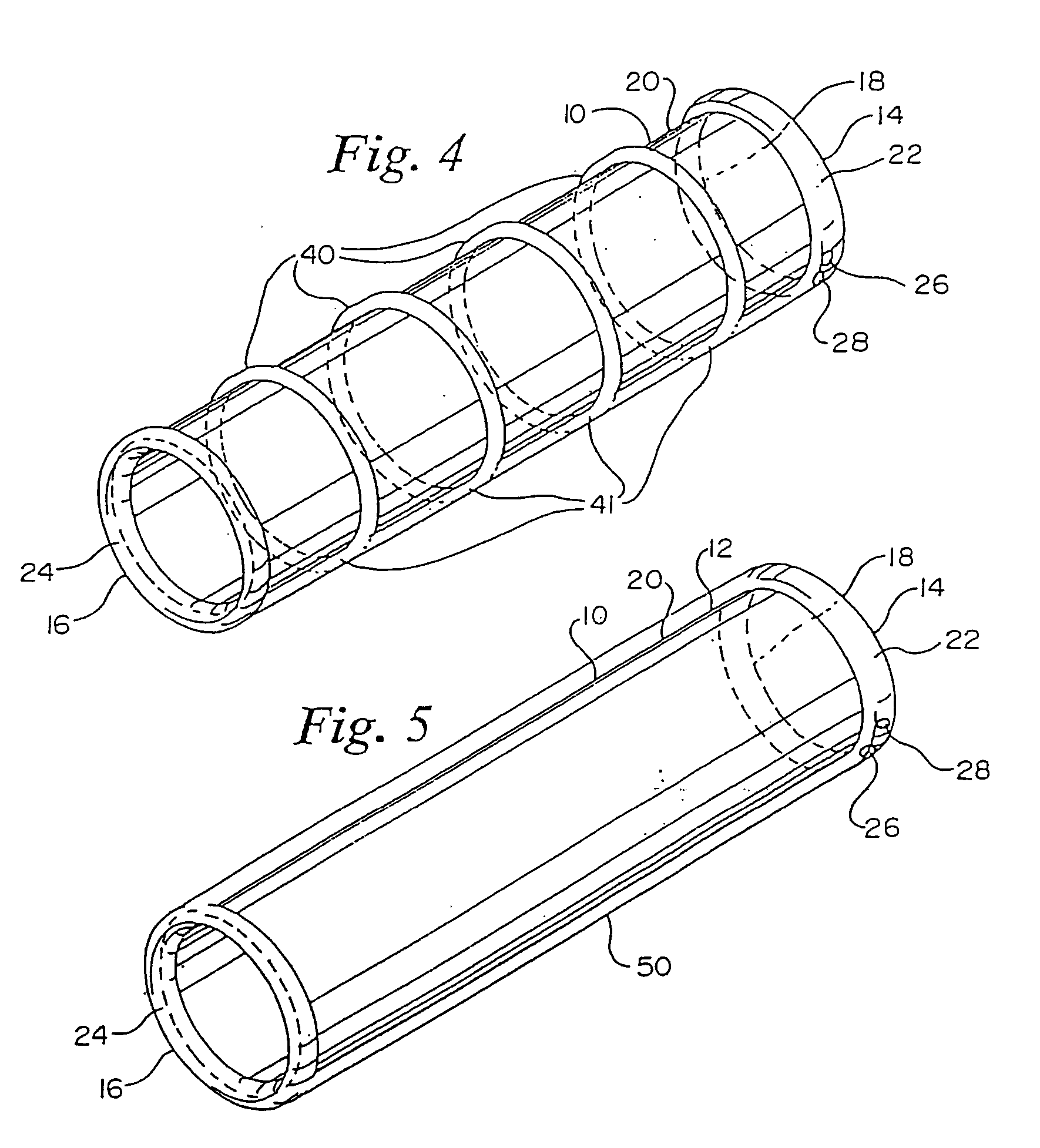 Endovascular apparatus