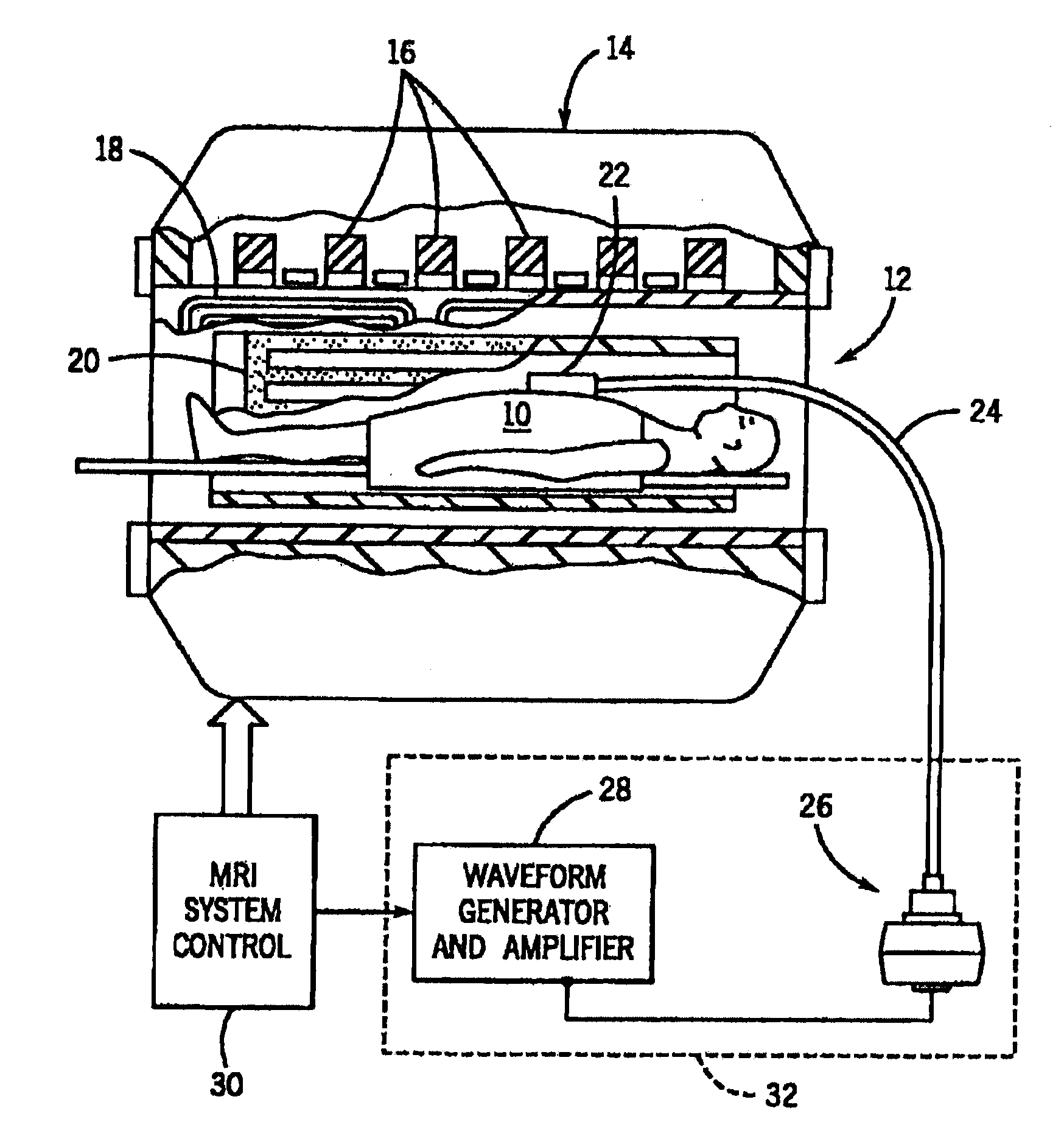 Flexible Passive Acoustic Driver for Magnetic Resonance Elastography