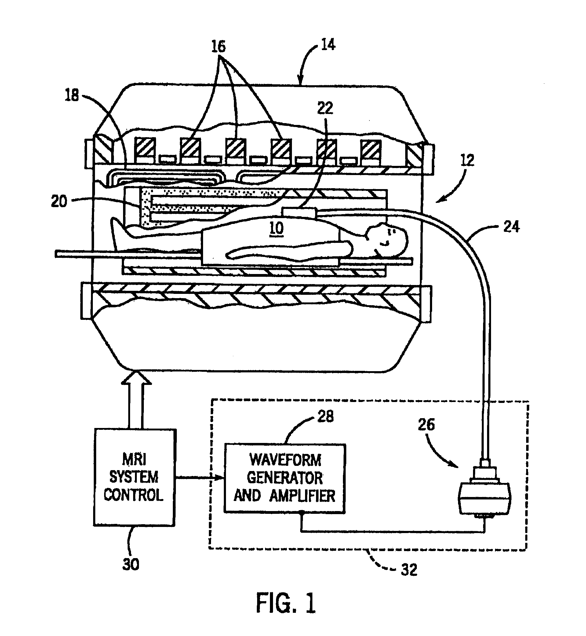 Flexible Passive Acoustic Driver for Magnetic Resonance Elastography