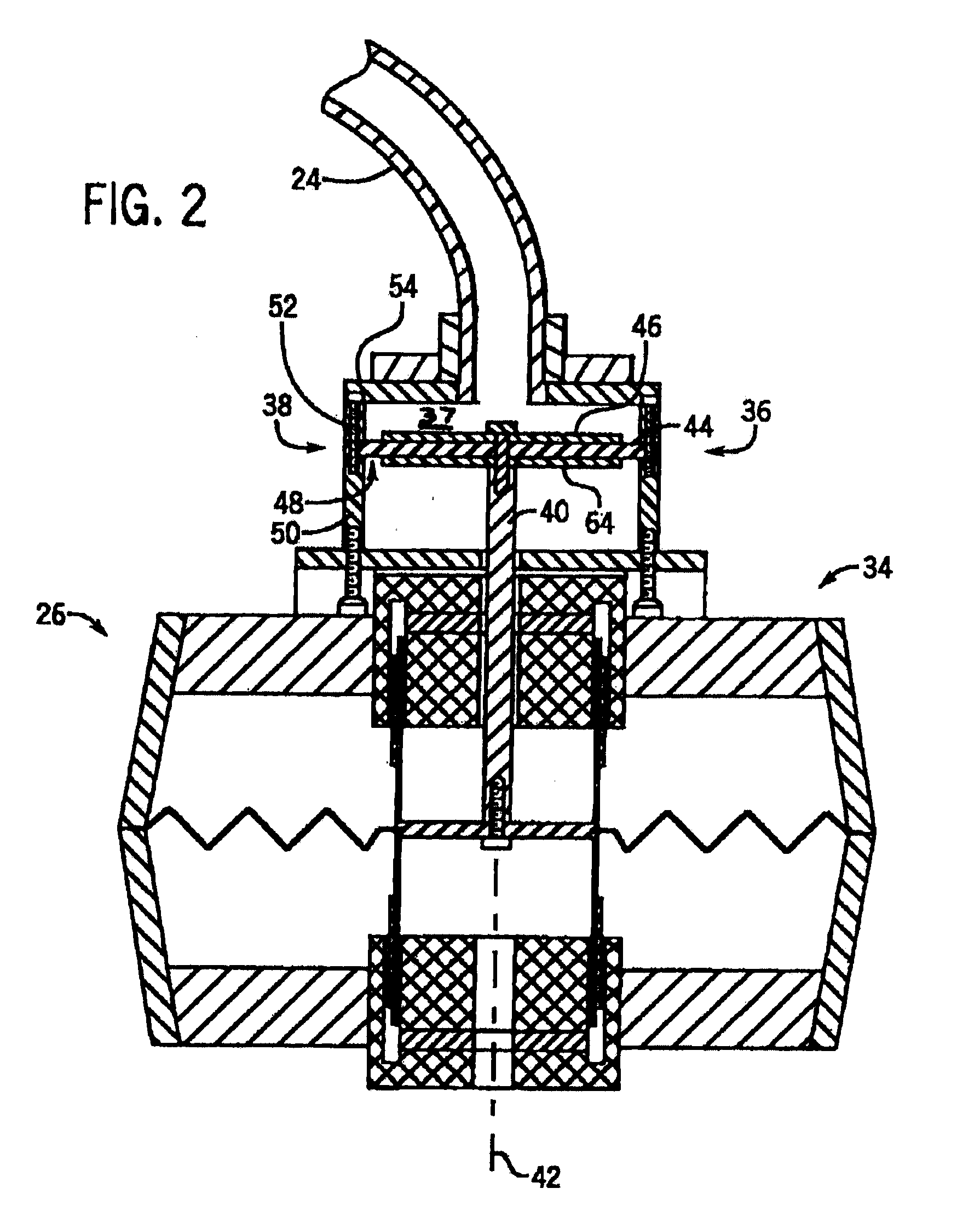 Flexible Passive Acoustic Driver for Magnetic Resonance Elastography