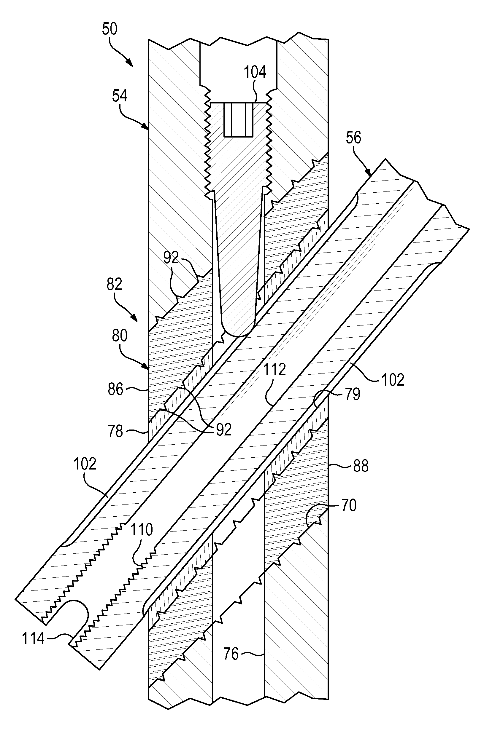 Nail-based compliant hip fixation system