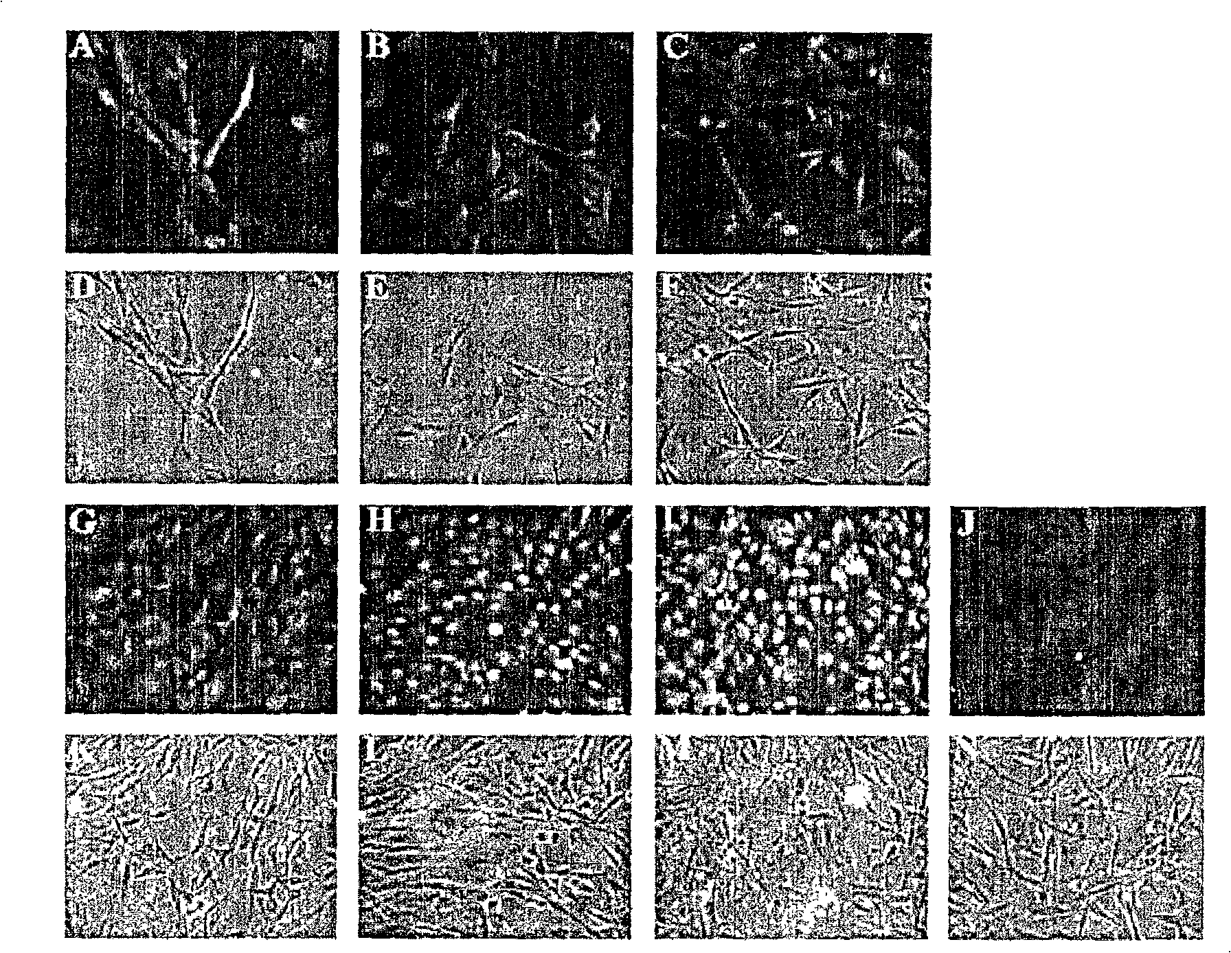 Method of preparing cell for transplantation