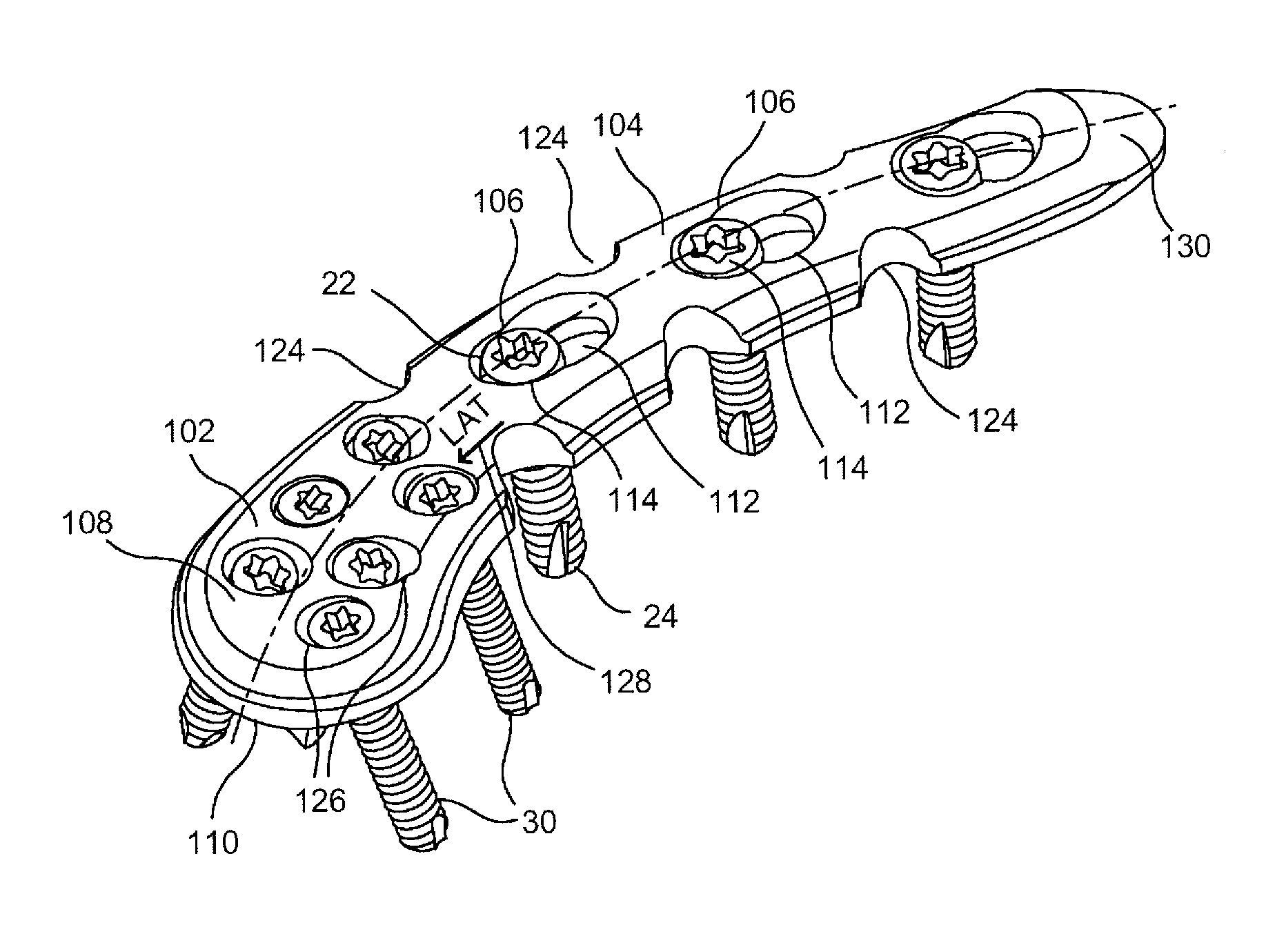 System and method for minimally invasive clavicle plate application